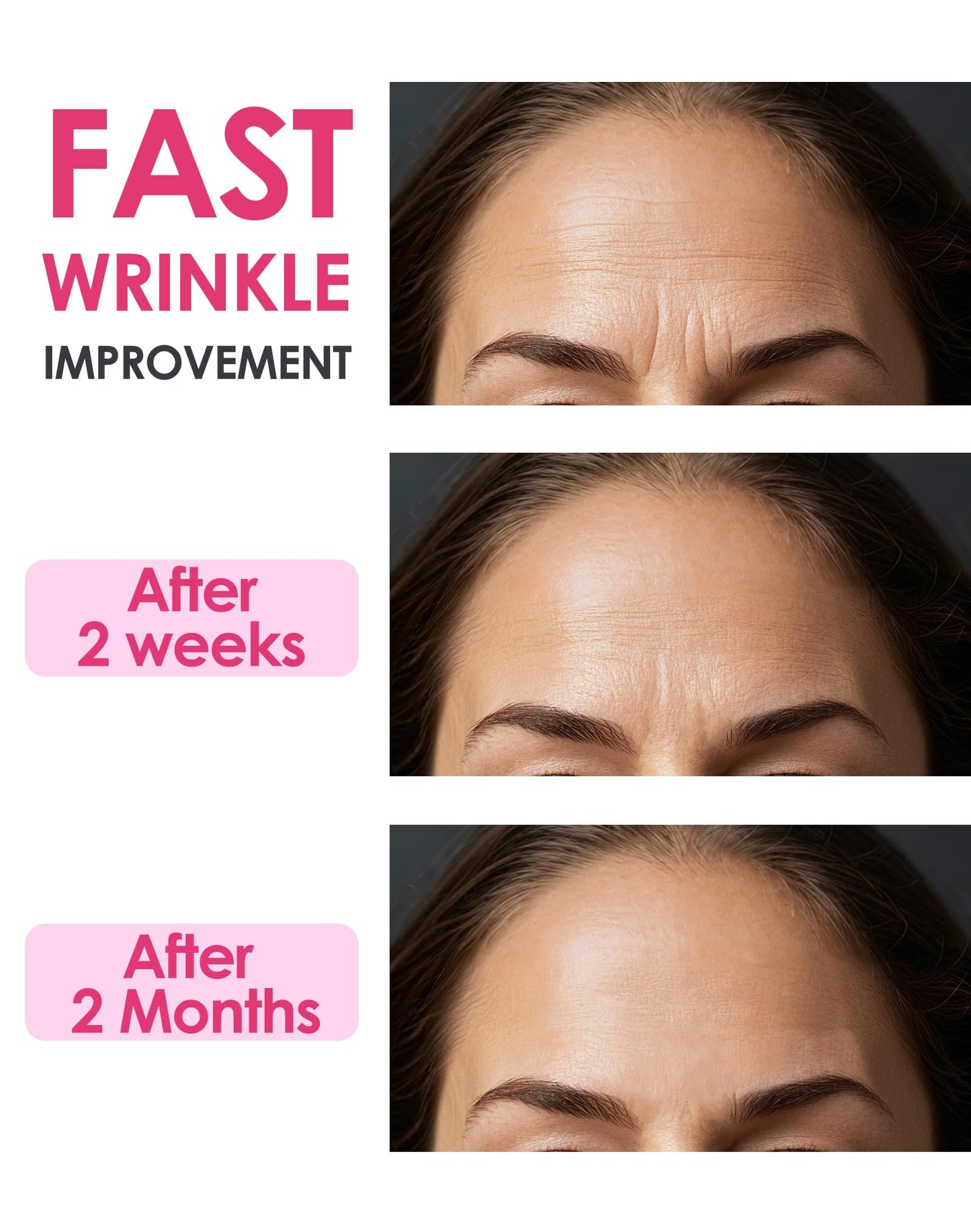 Forehead Wrinkle Patches Overnight, SFUCHIN 15 PCS T Zone Lifting Multi Point Support Facial Patches, Full Coverage for Forehead Wrinkles & 11 Lines, Anti Wrinkle Treatment for Smooth Fine Lines