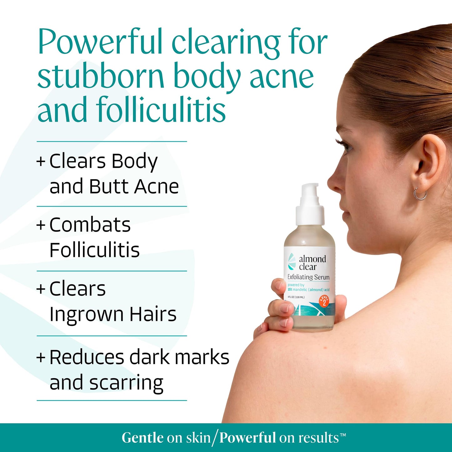 Almond Clear Level 2 Serum | Mandelic Acid Body Serum for Acne, Folliculitis, Aging Skin, Ingrown Hairs, Dark Spots on Face, Chest, Butt, Back, Thighs, Arms | 4 oz