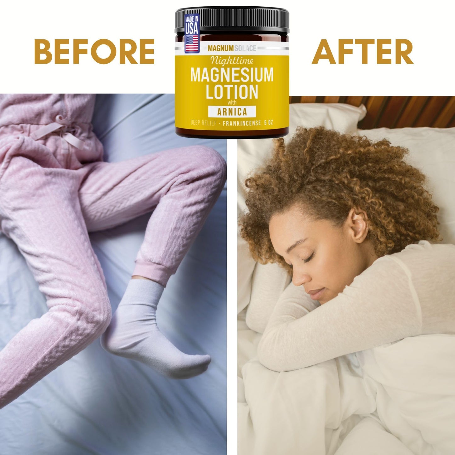 Magnum Solace Nighttime Magnesium Lotion with Arnica – Soothing Relief & Relaxation, Highly Concentrated Magnesium for Muscles & Joints – Apply to Legs or Feet Before Bed – Skin-Friendly