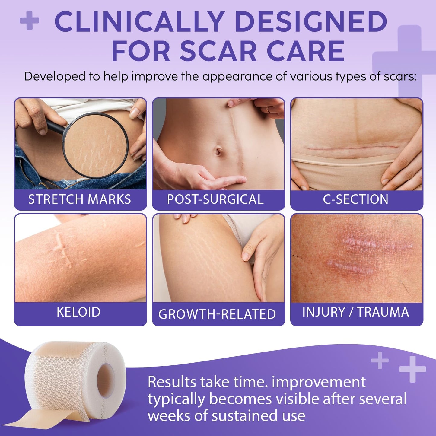 Silicone Scar Sheets,Silicone Scar Tape 1.6'' x 60'',Reusable Professional Silicone Scar Sheet for Surgical Scars,Tummy Tuck, Keloid, Burn, Acne,C-Section