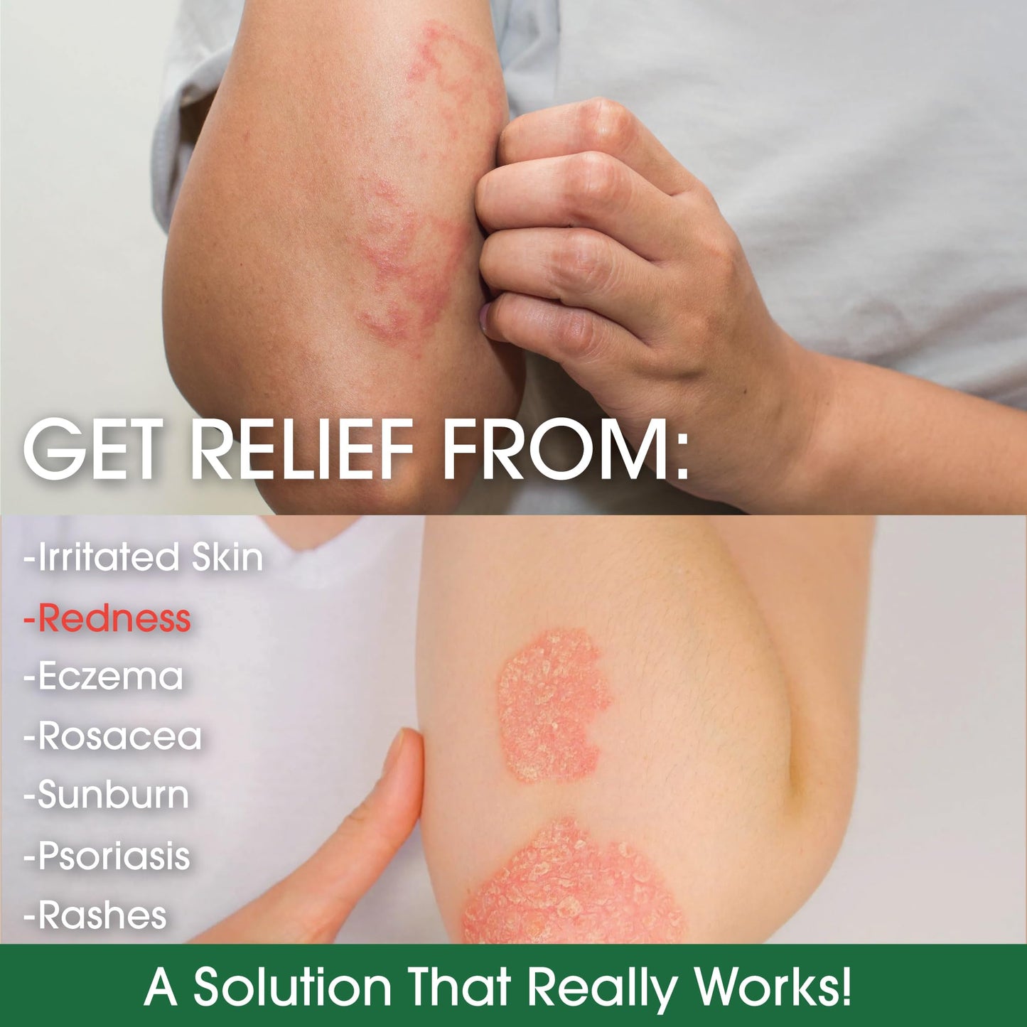 Green Leaf Naturals Manuka Honey Eczema Cream Moisturizing Lotion Fragrance Free for Psoriasis Relief - Itchy, Dry Skin Ointment - Skin Soothing Moisturizer - Body & Face Cream - Kids & Adults 4oz