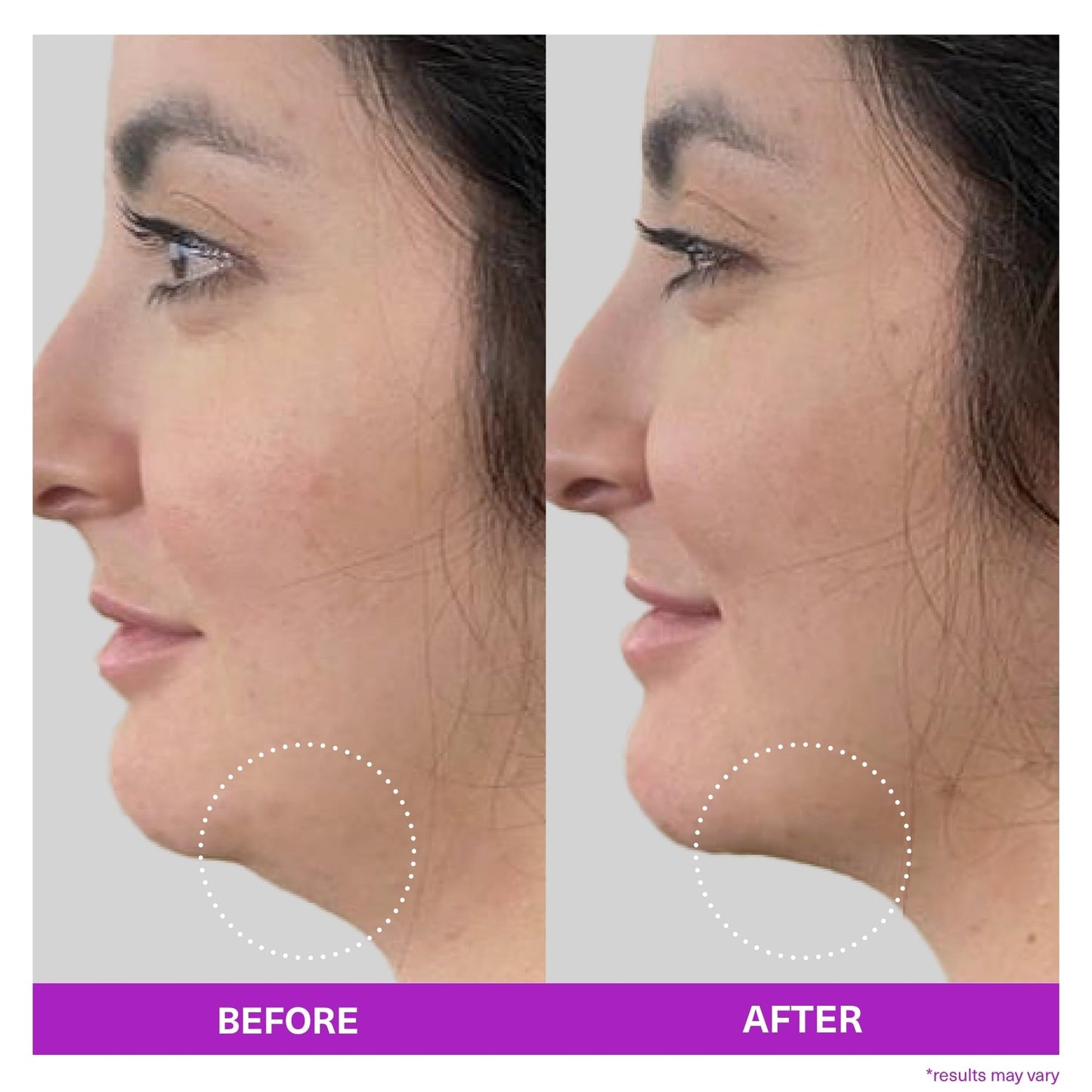 SickScience ShapeShift Advanced Jaw & Neck Firming Serum - Double Chin Reducer, Face Tightening Treatment with Exosome Technology to Lift Sagging Skin & Wrinkles in both Women & Men, 1.7oz