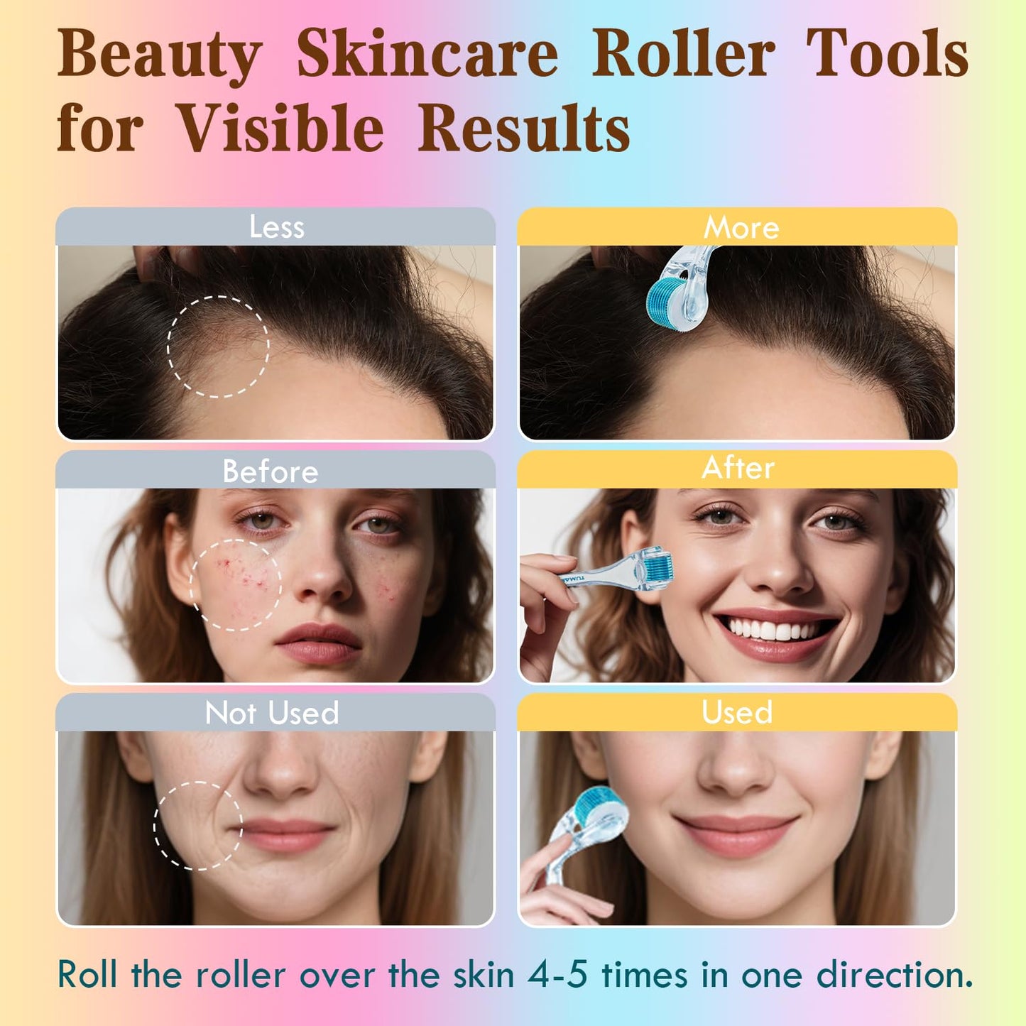 Derma Roller - TUMAKOU Microneedling Microneedle Roller for Face Scalp Hair - Beard Micro Needling Derma Roller at Home for Women and Men (White)