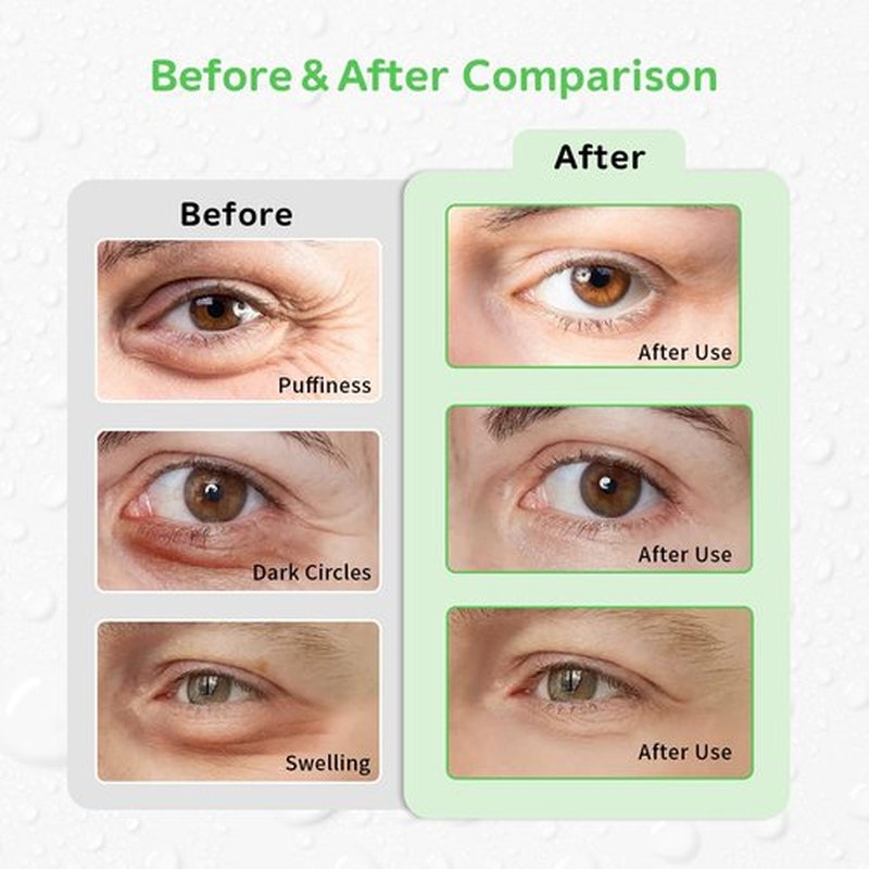 CONBELLA Gel Ice Pack Reusable Cooling Eye Pads and Under Patches,Eye Hot Cold Treatment for Redness,Pain Relief Relax (Green leaves)