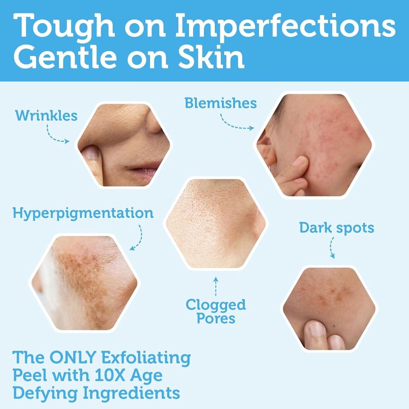 Glycolic Acid Peel - AHA BHA Exfoliant for Age-Defying Skin | Clinical Strength Formula with Aloe Vera & Manuka Honey