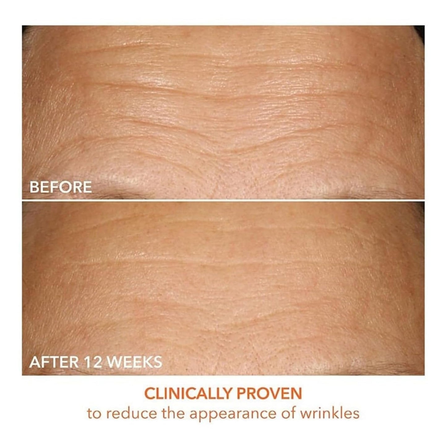Dr Dennis Gross Vitamin C Serum