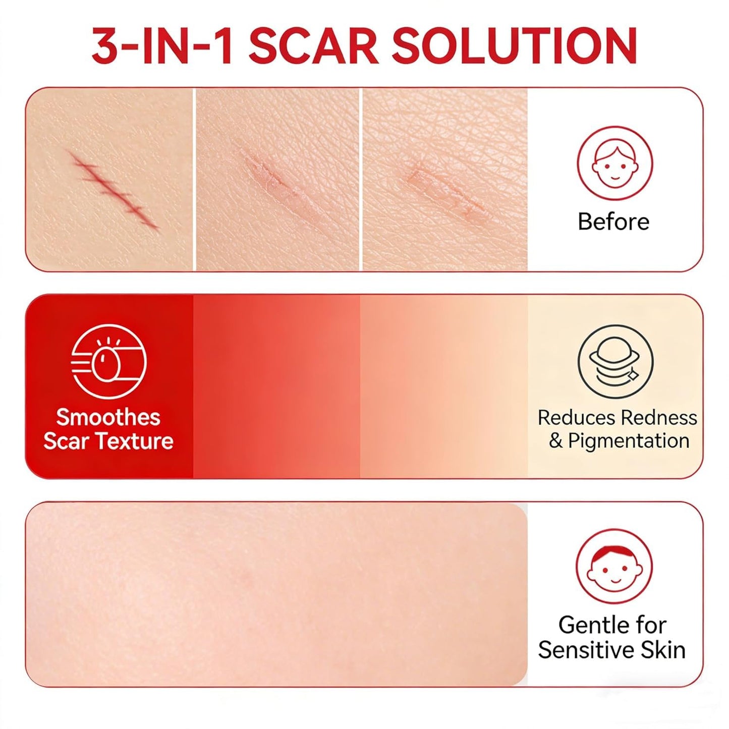 CleJoy Scar Soothing Cream & Smoothing Cream for Scars - Gentle Care for Sensitive Skin, Helps Improve Appearance of Scars, Reduces Redness, Lightweight Non-Greasy Formula