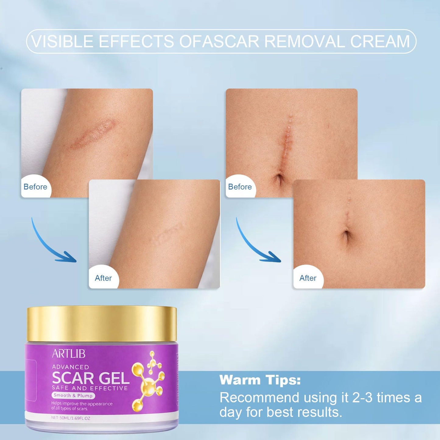 Scar Cream,Silicone Scar Gel,Helps Reduce Surgical Scars,Acne,Burn,Keloids Bump,Stretch Marks, Advanced Scar Removal Cream for Old and New Scars(1.69oz)