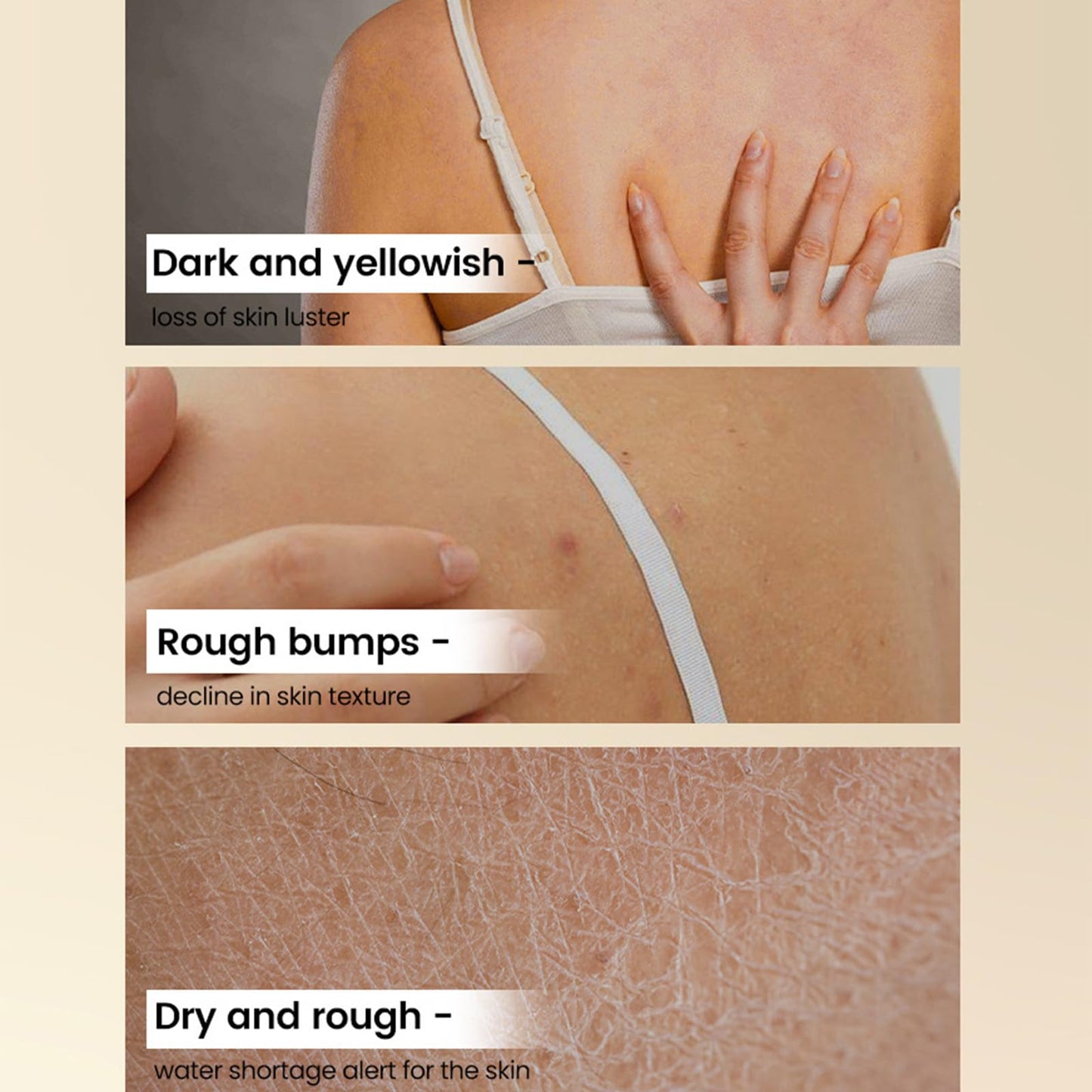 TUOSHITONG Glycolic Acid Exfoliating Body Stick,Exfoliating Lotion Stick,Smooths Rough Skin,Reduces the Appearance of Cellulite,Effect Radiant Skin,BodyCare Balm for Underarms,Legs,Body /2.65 Oz