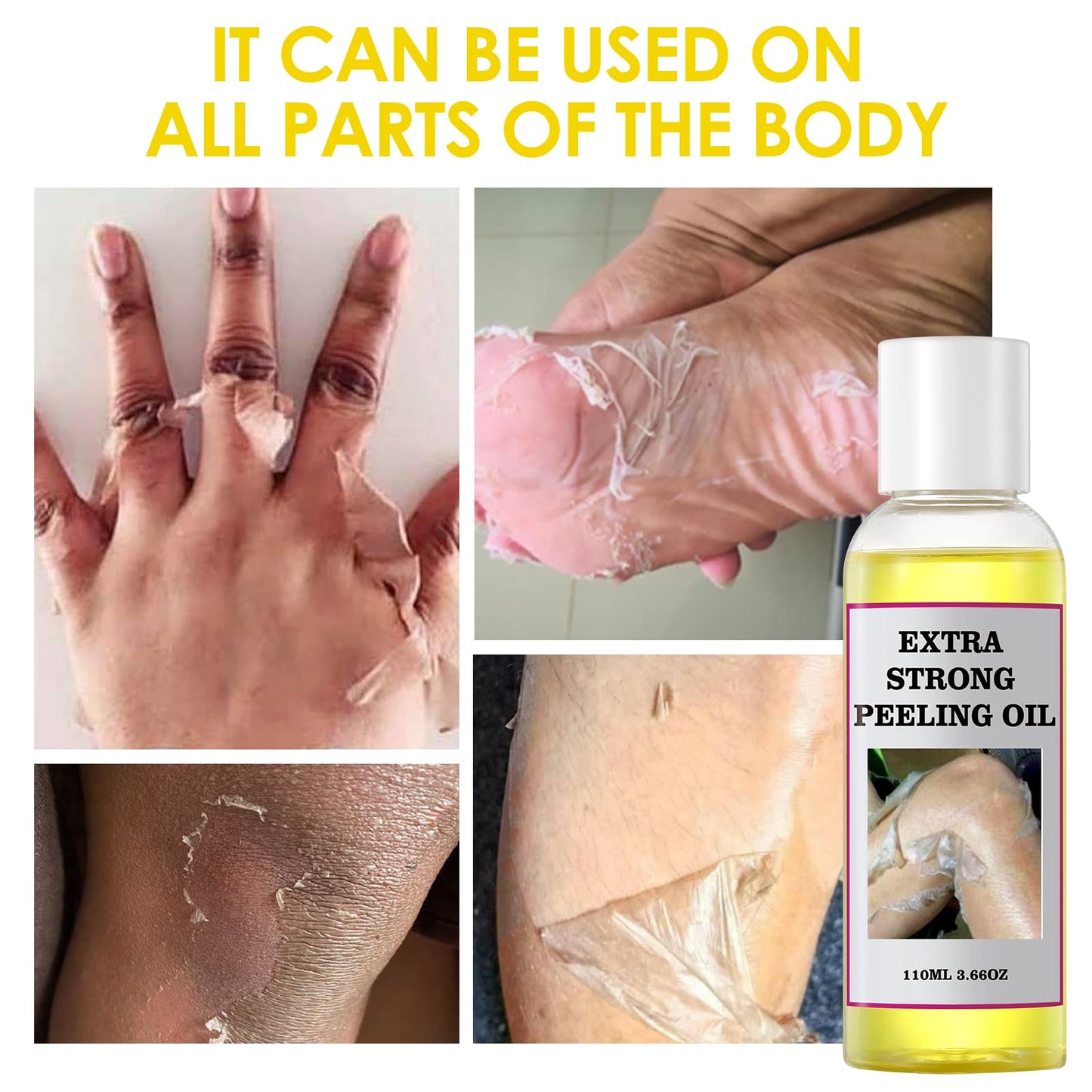 YAFUSIPE Yellow Peeling Oil for Dark Skin Strong Peel Oil Extra Strength Exfoliating Chemical Exfoliant Peels Solution at Home Body Peeling for Exfoliate Body Hand Foot Knuckle All Skin Type 3.66 OZ