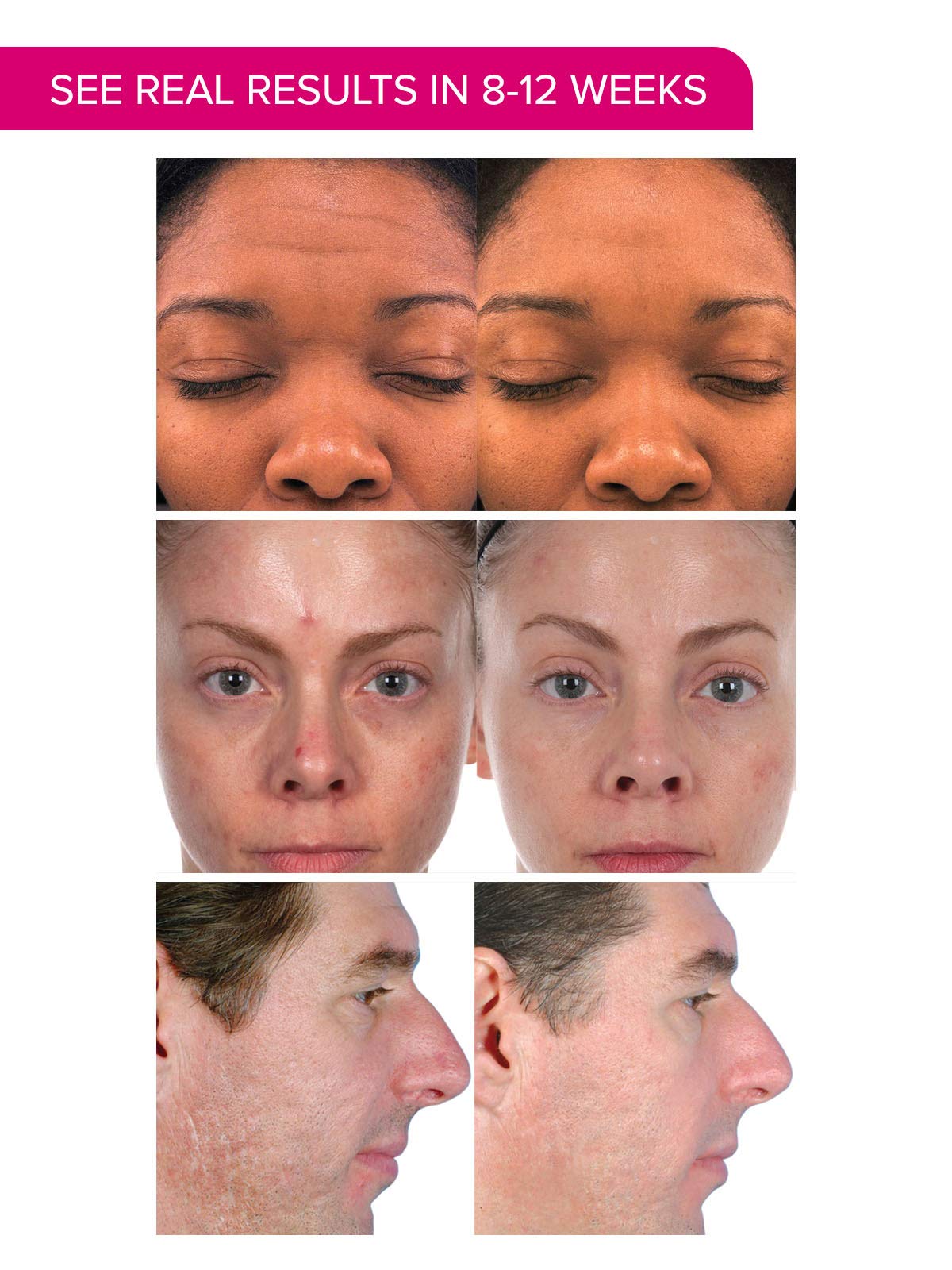 PMD Personal Microderm Plus with Daily Regeneration System