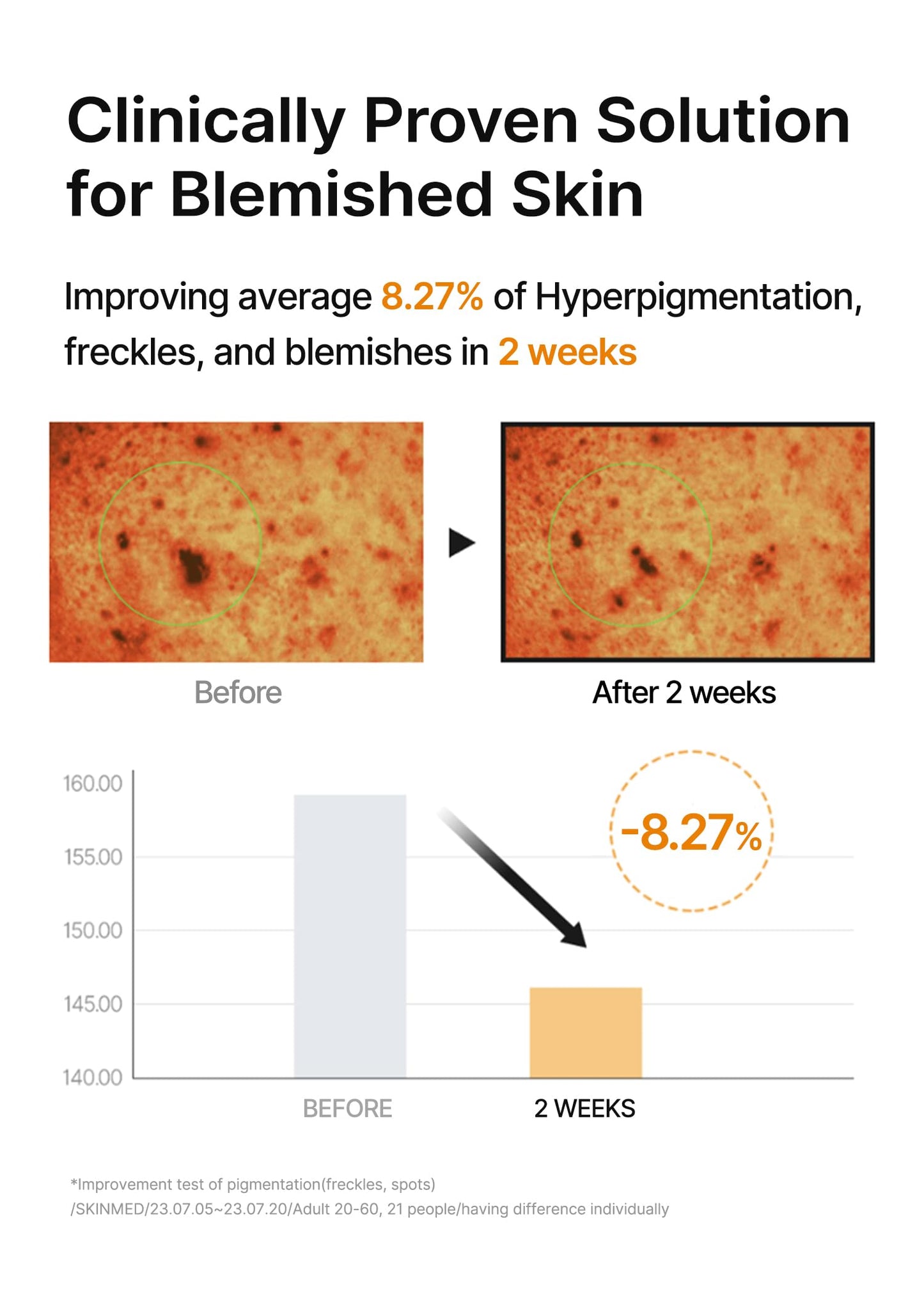 celimax Pore+Dark Spot Brightening Pad | Exfoliating Peeling Pads for Enlarged Pores, with Hyaluronic Acid, Pore Minimizer, Non-Irritating, Hydrating, For Sensitive Skin (80 pads)