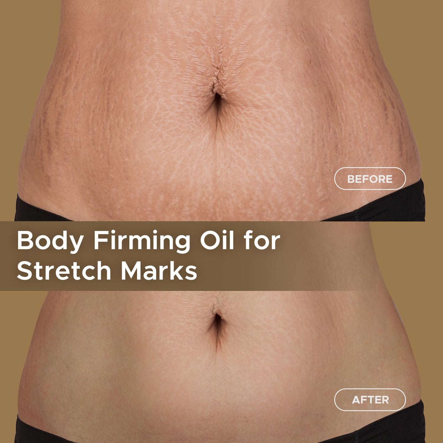 CHEOKINGBA Body Firming Oil, 3.4 Fl Oz Moisturizing Treatment Oil for Tightening After Shower
