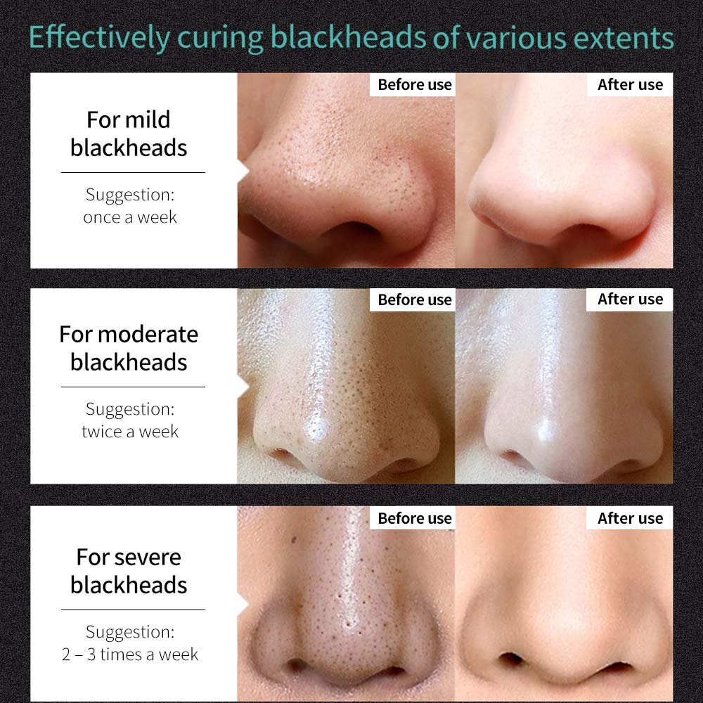MIESCHER Blackhead Removal Mask, Peel Off Facial Black Mask, Purifying Bamboo Charcoal Nose Facial, Removes Blackheads, Deep Pore Cleansing, Skin Cleansing for All Skin Types of Men & Women