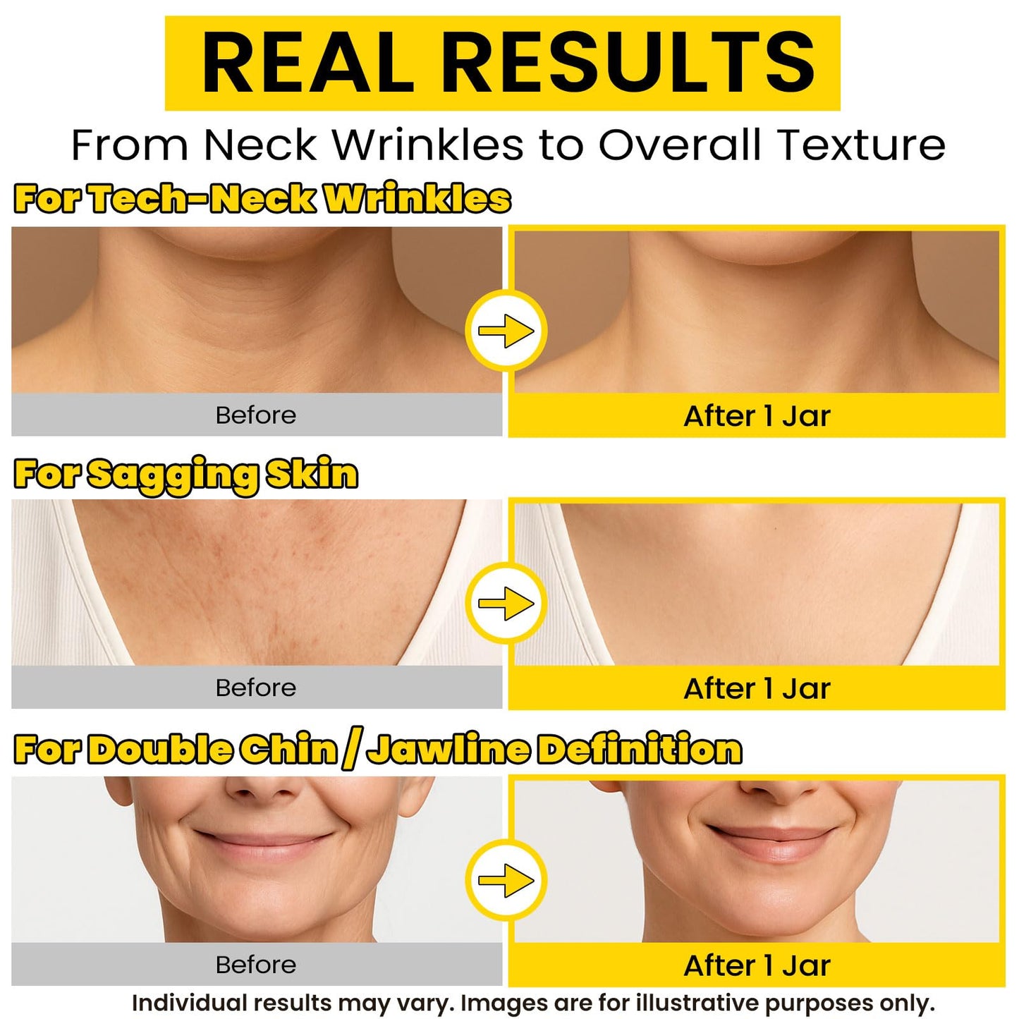 Chillihaer 8-in-1 Neck Firming Cream–Retinol & Triple Collagen Moisturizer for Neck,Face,Chest & Décolleté–Tighten, Lift&Smooth the Look of Sagging Crepey Skin, Fine Lines&Wrinkles–Women&Men,1.7 Fl Oz