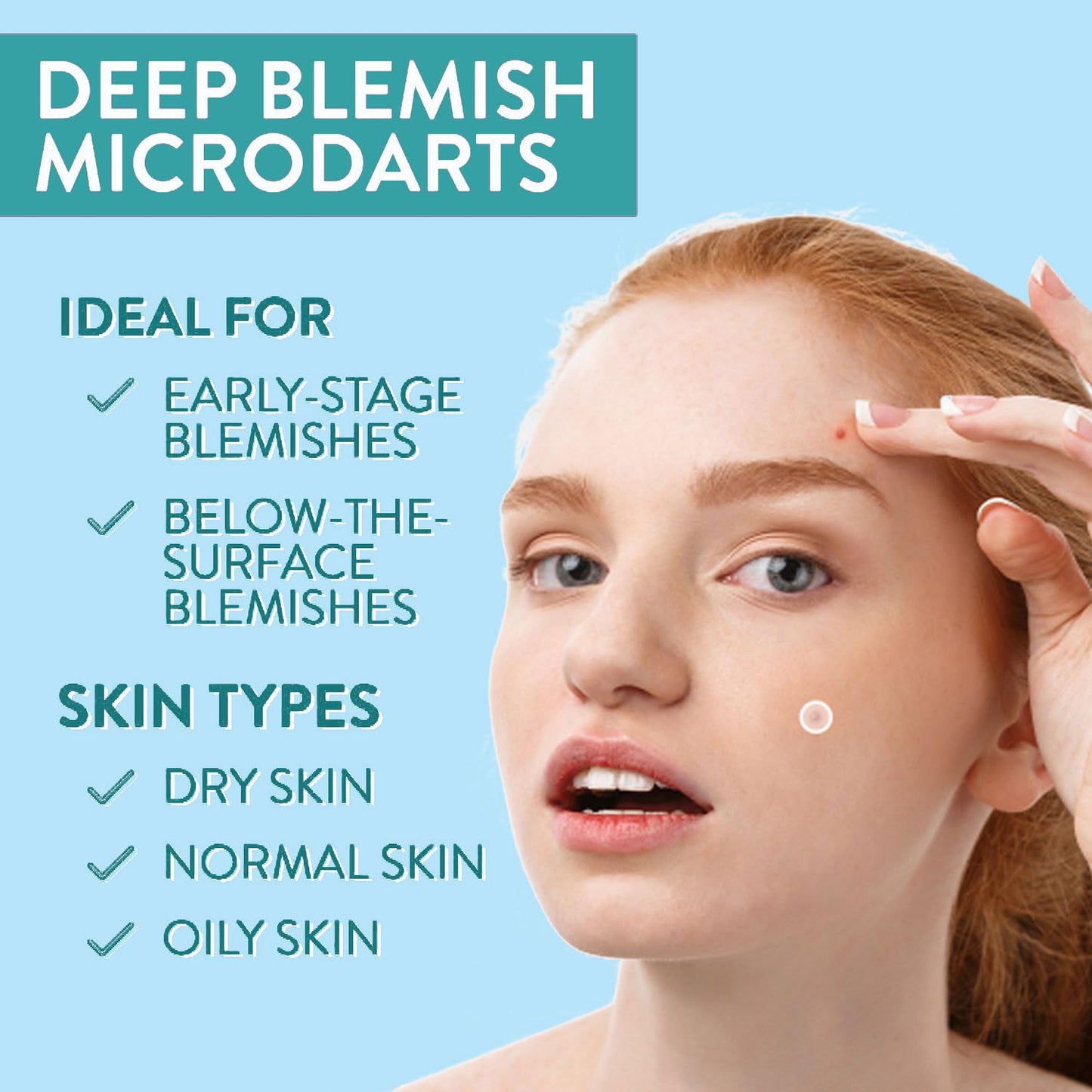 VILVIN Microdart Acne Patch for Deep Blemish - 9 Patches - Dark spot remover for face - Fast Acting Microdart Pimple Patches for face - Hyaluronic Acid, Tea Tree