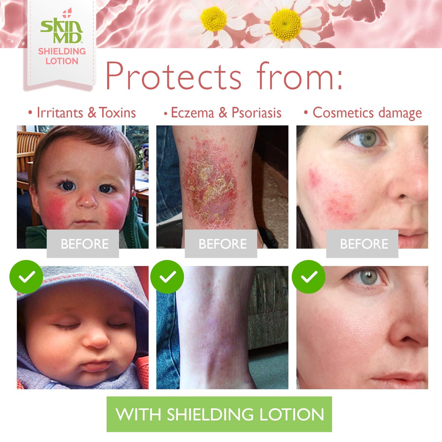 Skin MD Shielding Lotion Hydrating Body Lotion for Sensitive Skin with Dispenser | Non-Greasy, Fast-Absorbing Moisturizer with Plant-Based Ingredients, Eczema & Psoriasis Relief - 4oz 3-Pack