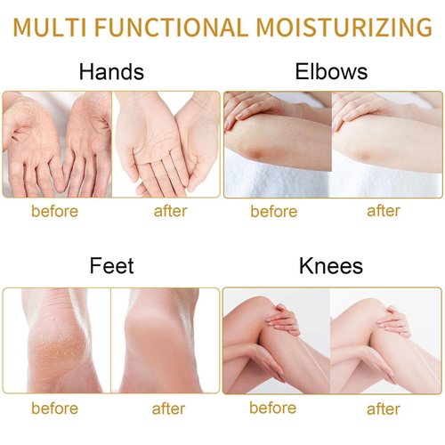 Feet Care Cream Foot Cream Hand Moisturizer for Dry Cracked Heels Knees Elbows Callus,Smoothing Foot Cream for Dry Cracked Heels and Feet Softens Skin Exfoliates Dead Skin for Men Women,20g- Lavender