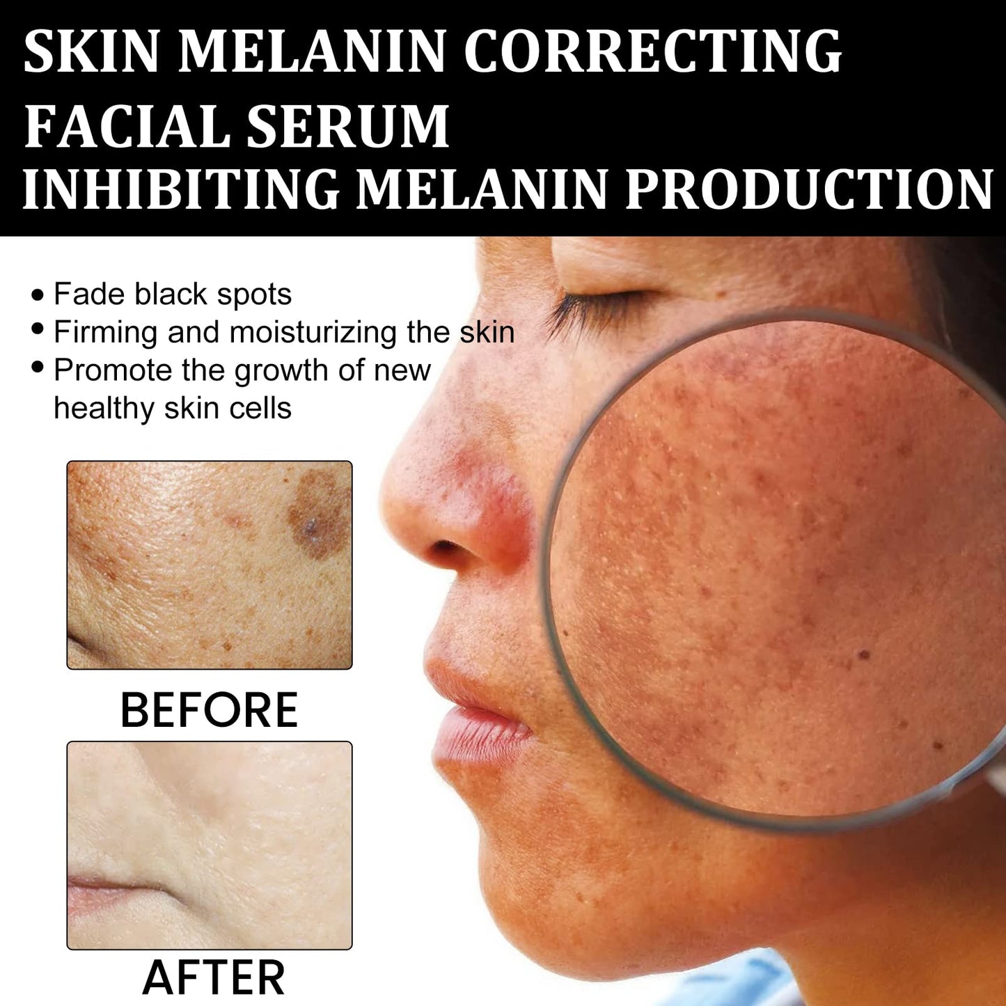 Melanin Correcting Facial Serum, Dark Spot Corrector Daily Face Serum, Melanin Correcting Facial (3pcs)