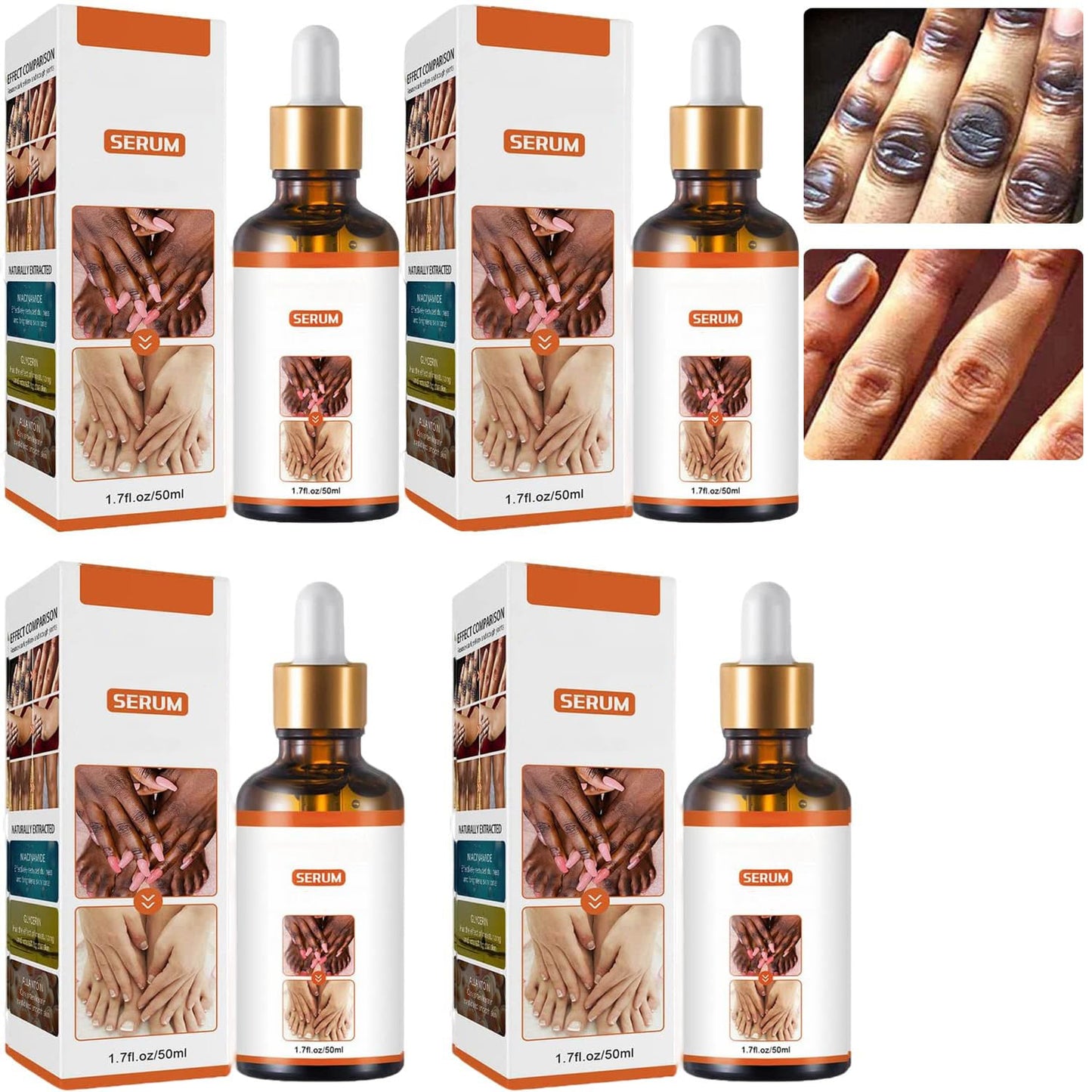 JASUBAI Body Moisturizing Serum for Dry Skin, Nourishing for Elbows, Knees and Fingers