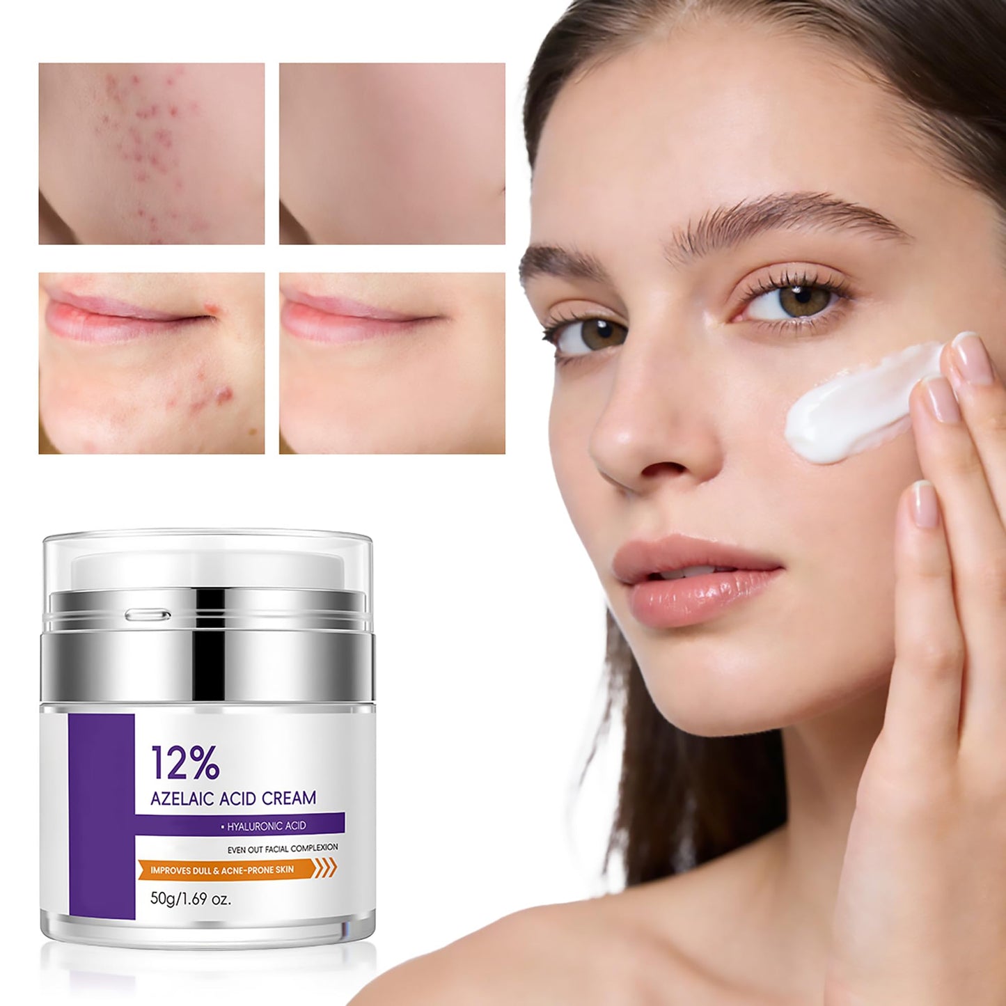 12% Azelaic Acid Cream for Face，Acne Cream，Azelaic Acid Serum for Acne & Post-Acne Marks，Fades Acne Scars & Soothes Skin，Regulates Sebum Production，Suitable for Oily & Acne-prone Skin Care，1.69 OZ