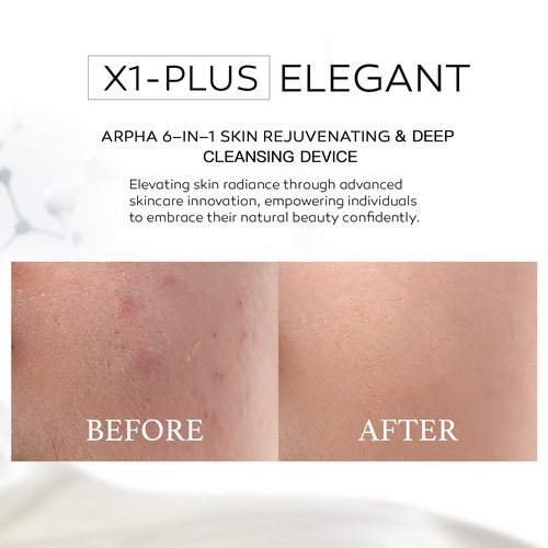 Arpha Titanium Ion Skincare Enhancer & Silicone Sonic Face Scrubber, for Skin Tightening, Brightening, Gentle Deep Cleanse, Mindful Glow Up, Only 135g, IPX7 Waterproof (Beige)