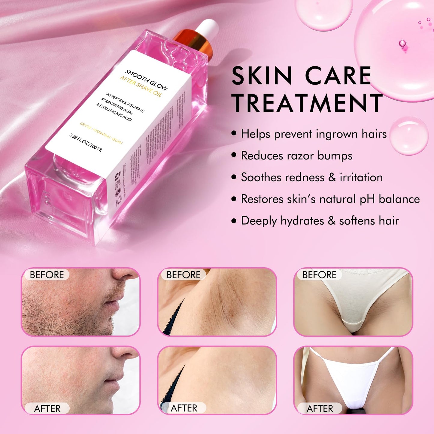 Premium After Shave Oil, 100ml Women's After Shave Oil for Smooth Skin - Strawberry AHA & Peptides to Prevent Ingrown Hairs & Razor Bumps, Fast-Absorbing Hydration, Vegan, Sensitive Skin Care