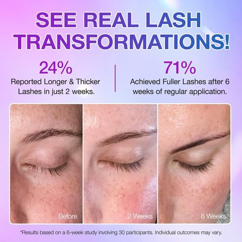 Lash Serum - Rapid Eyelash Growth Serum,eyelash serum,Lash Enhancing Serum for Eyelash Growth Thickness,Boost Thicker, Fuller, and Longer Lashes 5ml