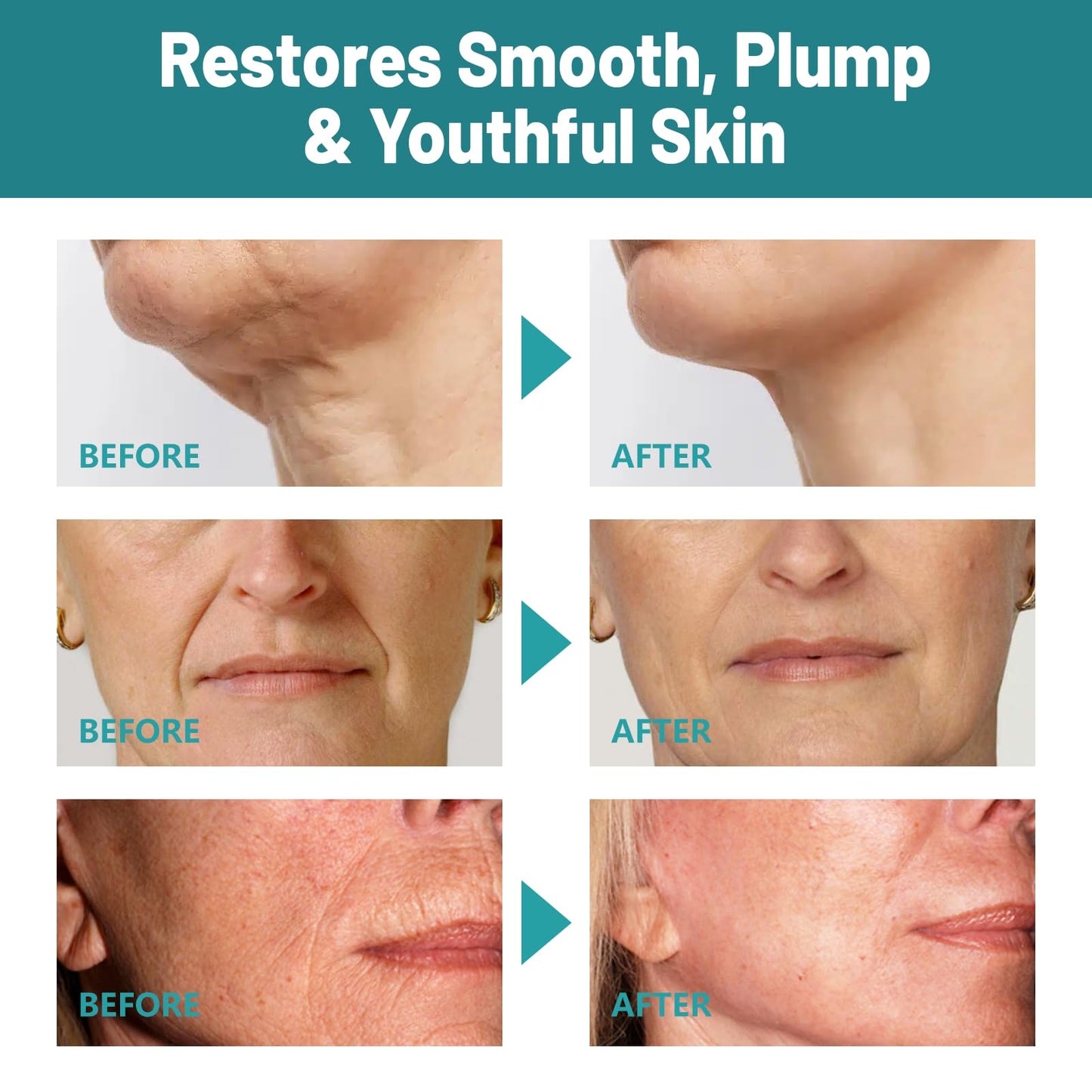 LBXX NEW Crepes skin cream for aging skin ，Crepes Skin Repair Treatment, Firming Cream with Hyaluronic Acid & Shea Butter to Deeply Moisturize & Tighten Wrinkly Dry