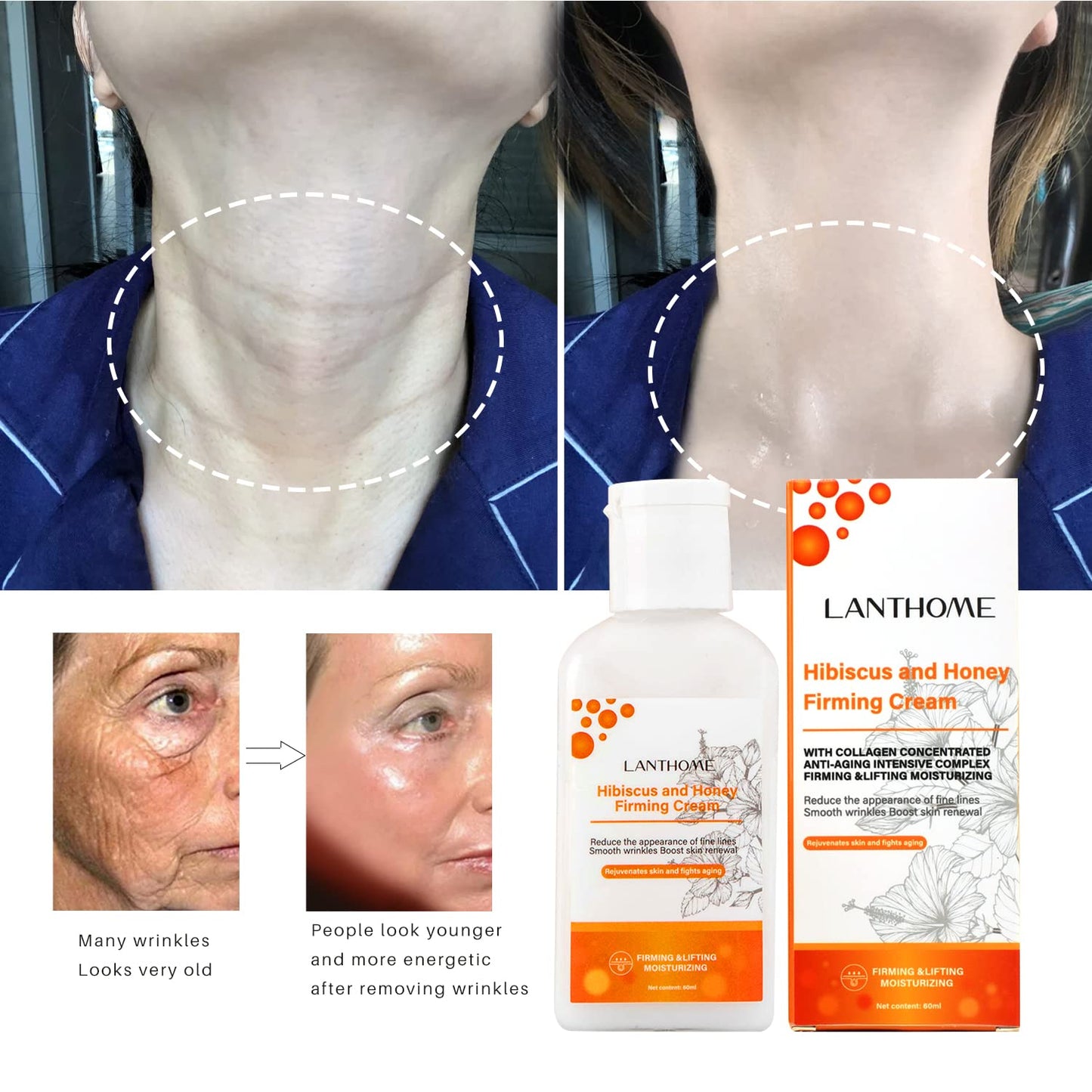 Lanthome Hibiscus and Honey Firming Cream(60ML), Neck Firming Skin Tightening Cream With Collagen & Hyaluronic Acid, Reduces the Look of Neck Lines,Tightens,& Smooths