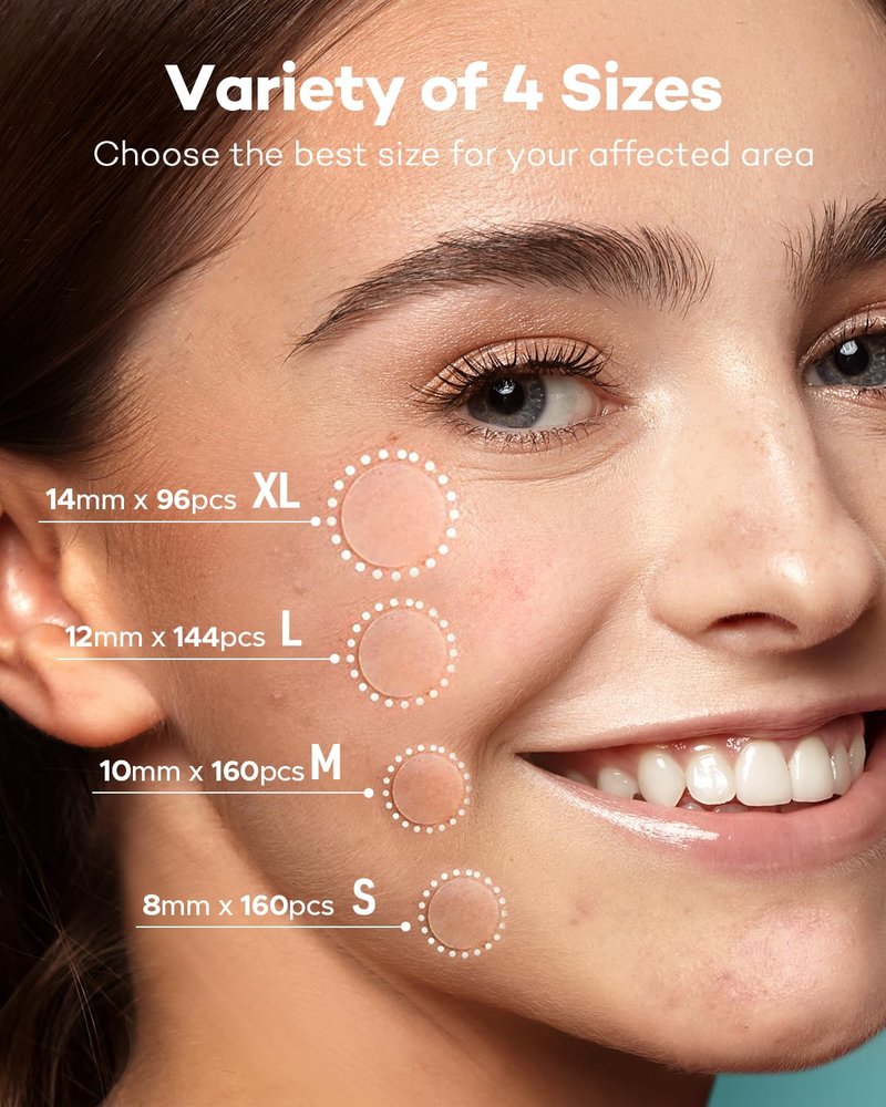 Acne Patches - Hydrocolloid Pimple Patch with Tea Tree & Calendula Oil | 560 Invisible Zit Patches in 4 Sizes