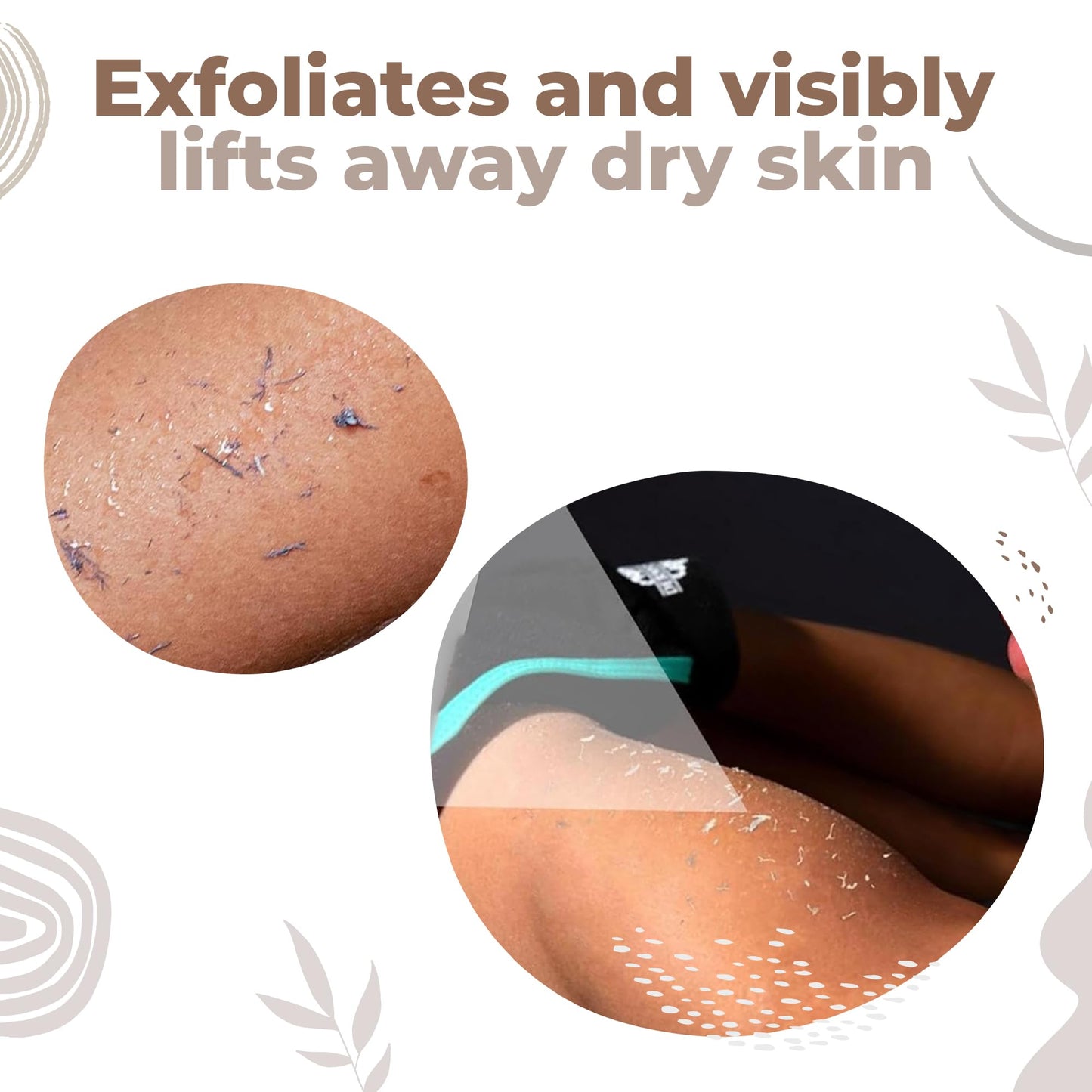 VELORIA Korean Exfoliating Mitt for Body - 2-Pack Exfoliating Glove Set - Dead Skin Remover for Body - Self-Tan Removal & Keratosis Pilaris Treatment