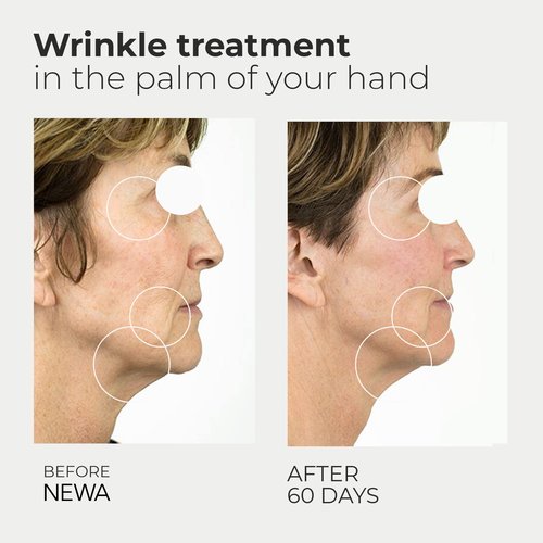 NEWA Classic Skin Care System Anti-Aging Facial Treatment Skin Tightening Technology for Home Use. Boost Oxygen, Increase Collage, Reduces Wrinkles (Include 1 Gel Pack) (Pink Classic.)