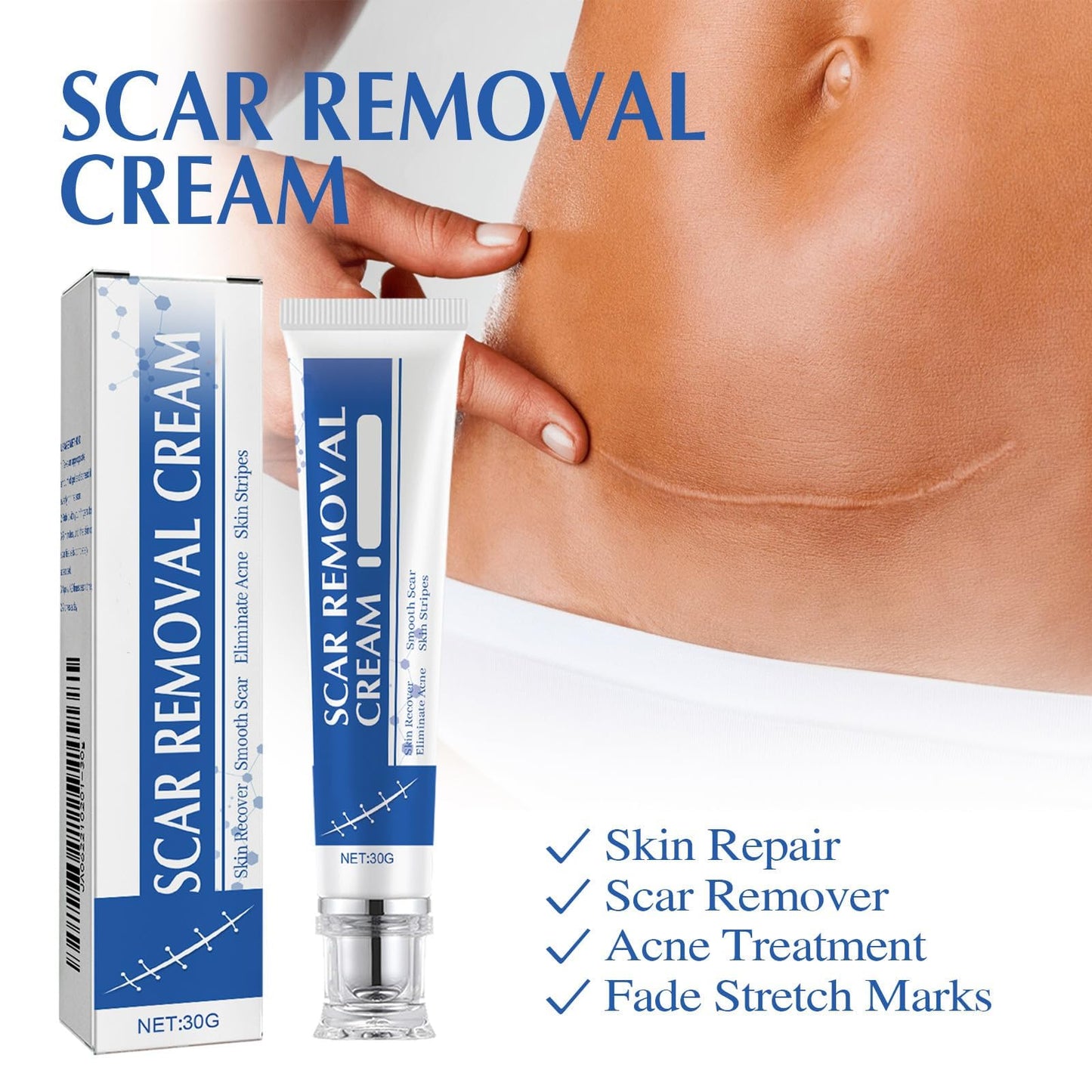 Scar Cream,Silicone Scar Gel,Scar Removal Cream,Scar Silicone Gel,Scar Gel,Scar Cream for Surgical Scars and Keloid Bump