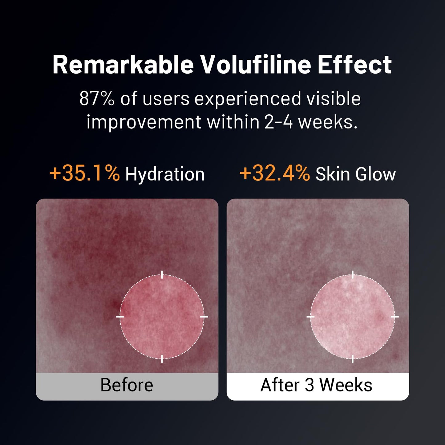 Volufiline Serum for Skin, Anti-Aging Serum for Face, 5% Volufiline + 40% Beta Glucan, Reduce Fine Line, Firming, Anti-Wrinkle Collagen Enhancer, Facial Serum for Visibly Plumper Skin