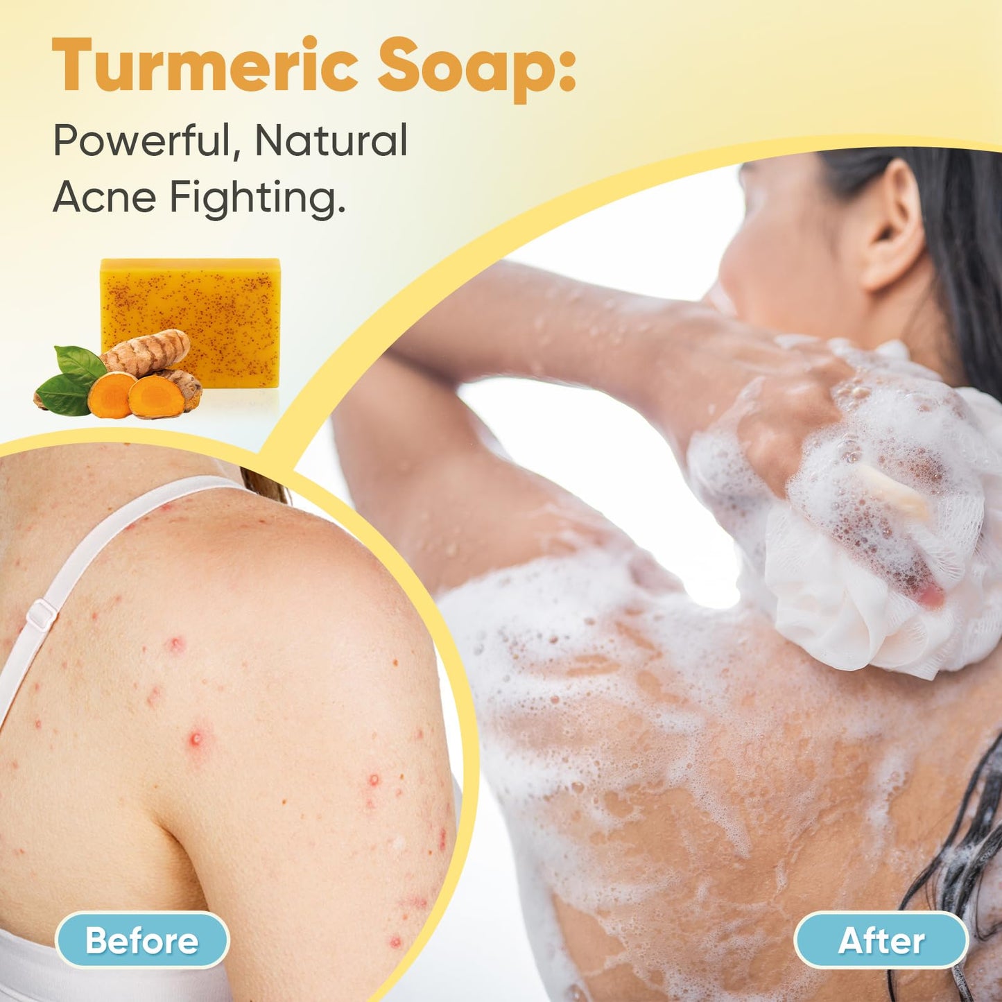 Treeroot 5 Pack Turmeric Soap, 80g Kojic Acid and Turmeric Soap Bar, Gently Clean the Face, Contains Retinol, Collagen, Vitamin C, Shea Butter, Used for Face & Body, SLS Free
