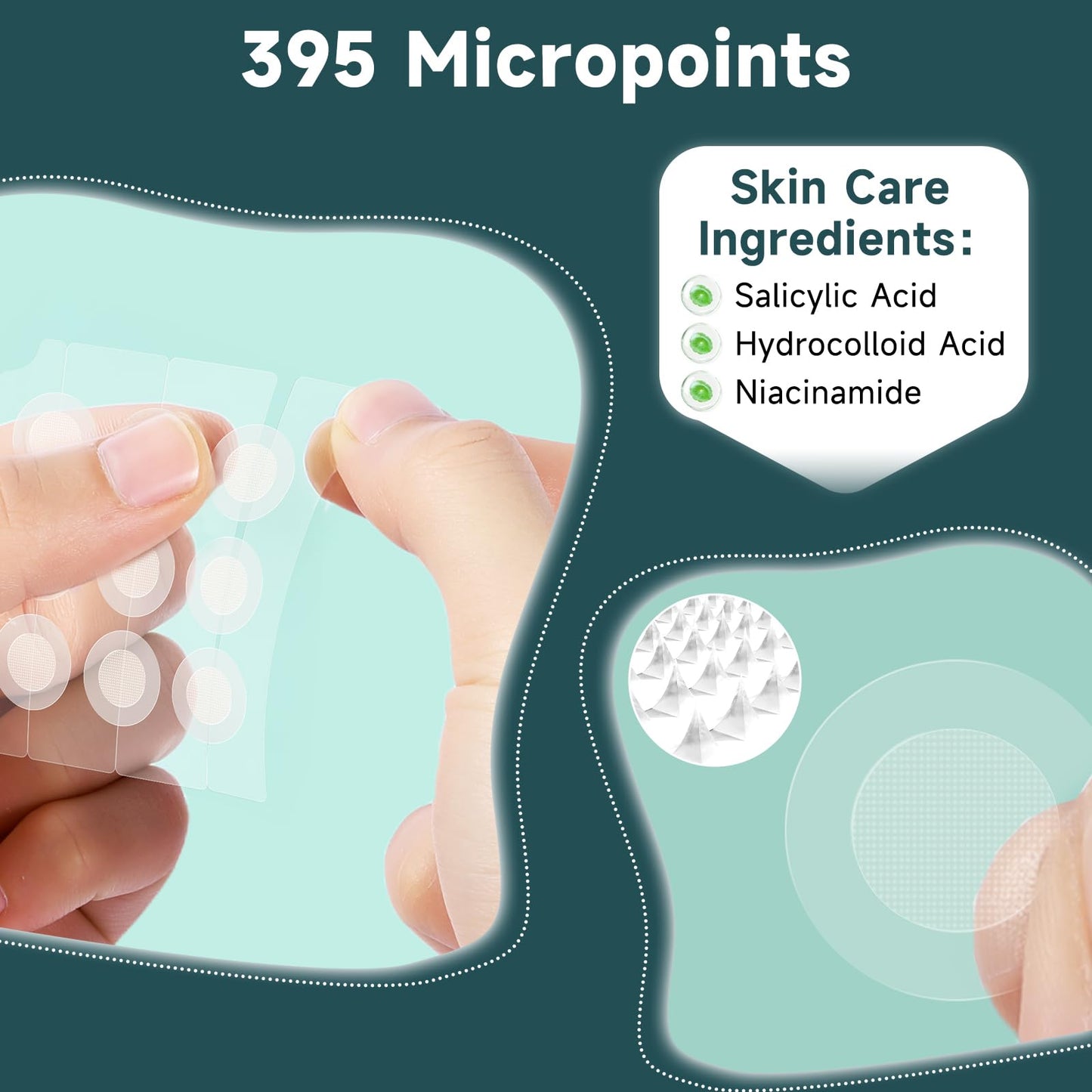 Microdart Pimple Patches for Face 9 Count,Hydrocolloid Acne Patches,for Early Stage Zits ,Spot Patch with 395 Microdart