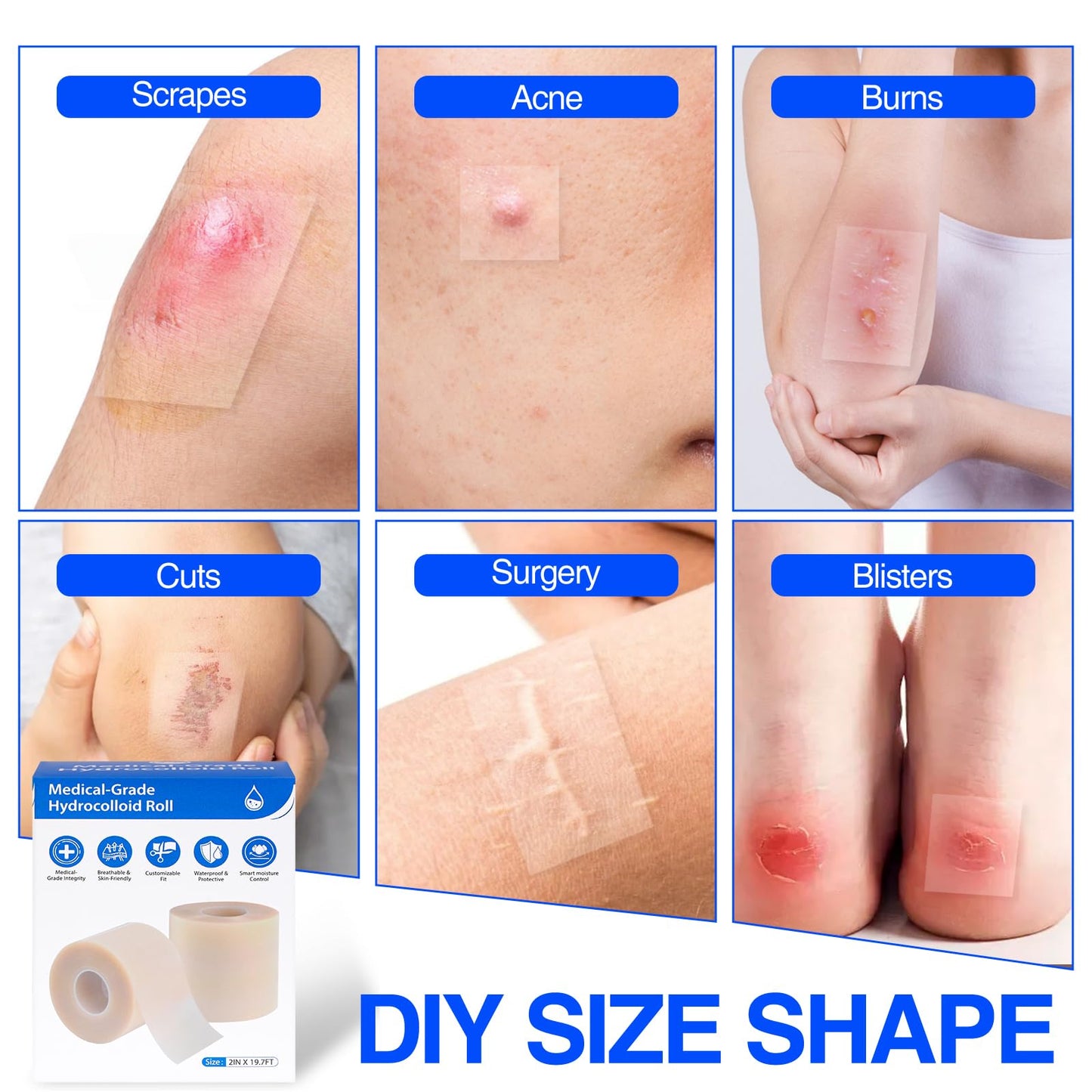 Hydrocolloid Bandages Roll 2" × 19.7' – Hydrocolloid Roll for Wound Care, Hydrocolloid Patch Large, Hydrocolloid Gel Bandages Hydrocolloid Dressing with Self-Adhesive, DIY Size Shape First Aid Kit