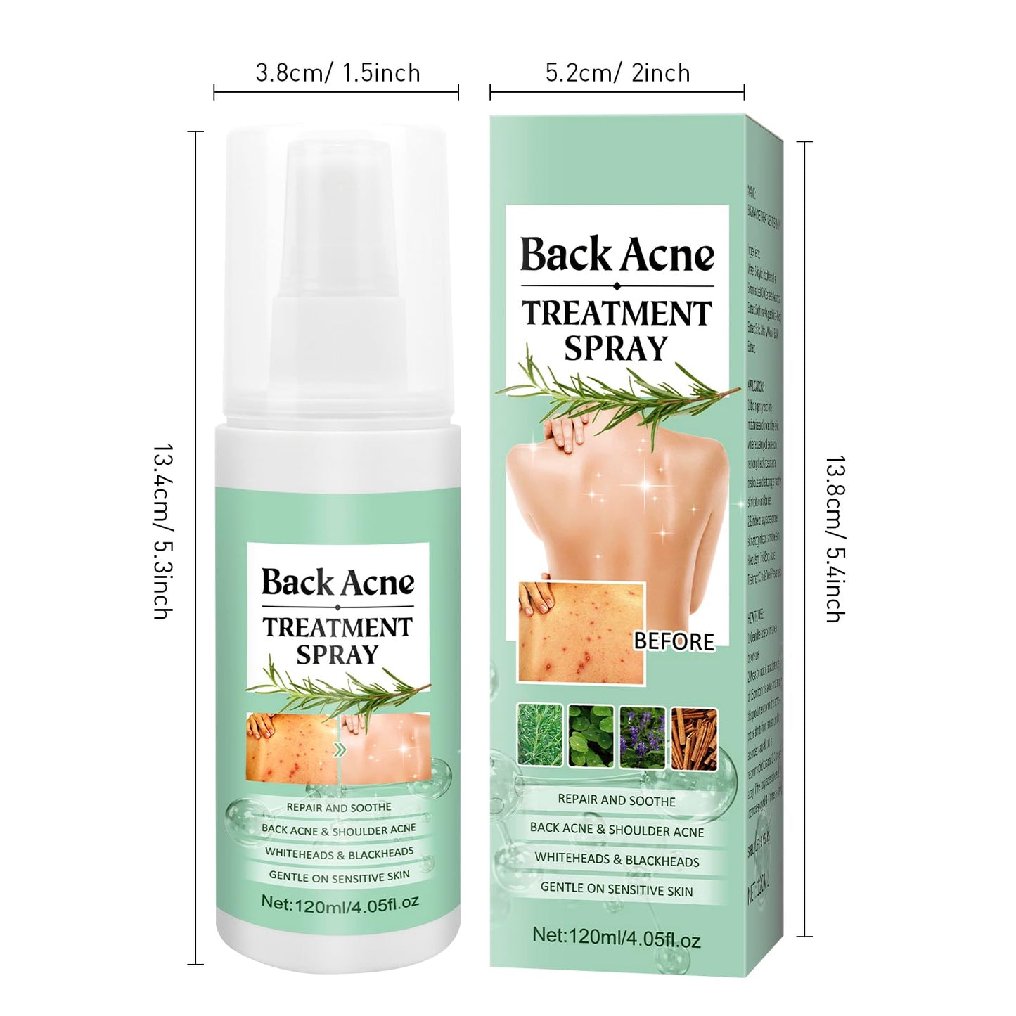 Back Acne Treatment Spray With Herbal Formula, 2% Salicylic Acid & Tea Tree Oil - Body Acne Solution, 120ml
