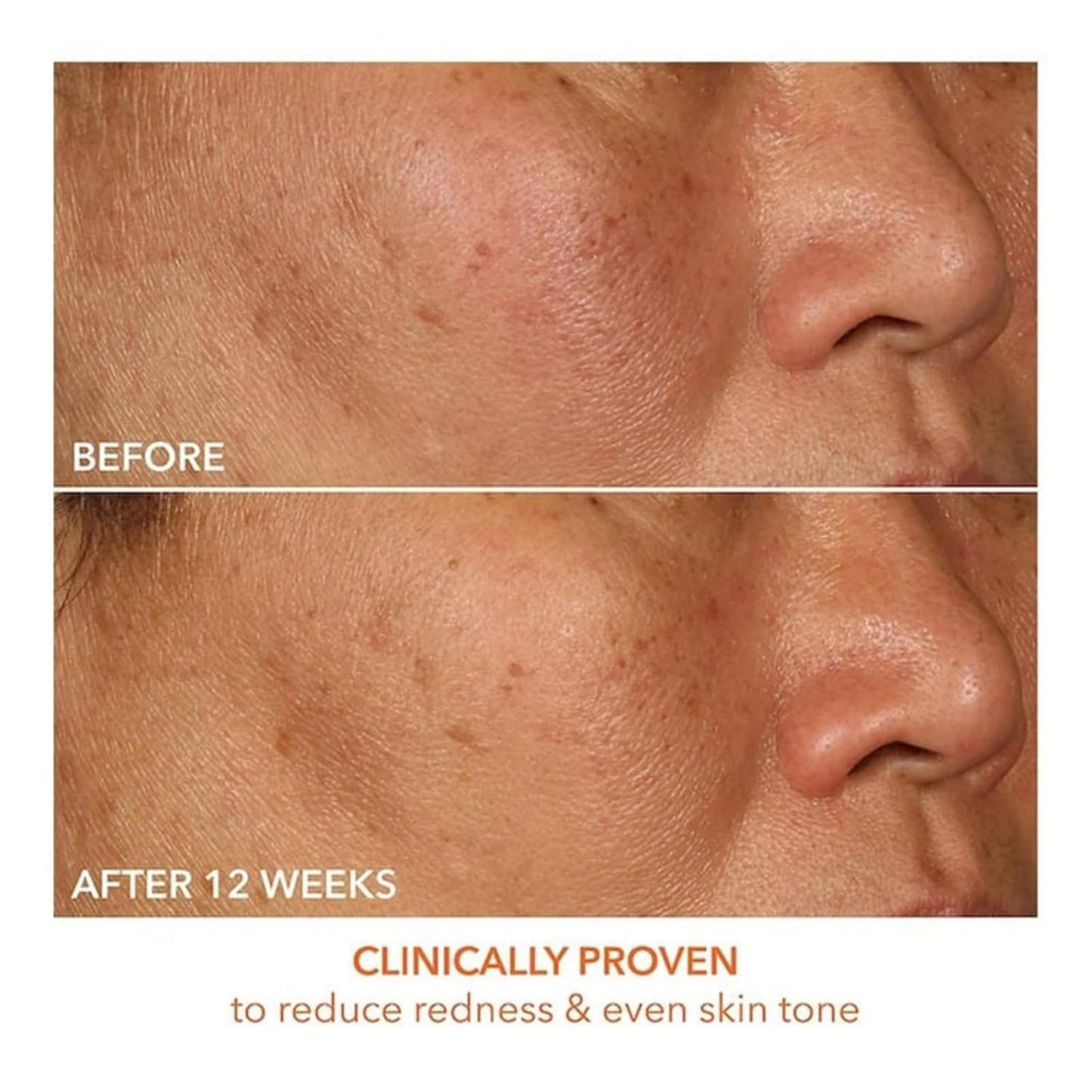 Dr Dennis Gross Vitamin C Serum