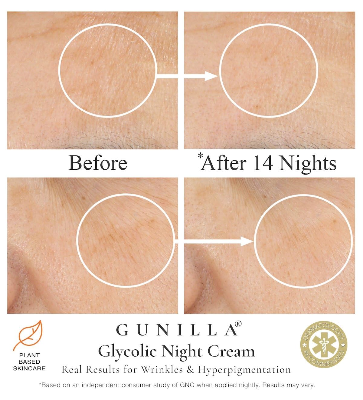 GUNILLA Glycolic Acid Night Cream - Refine, Resurface & Reduce Fine Lines, Wrinkles, Dark Spots, Congested Pores While Brightening Complexion. Gentle - Natural - Vegan (2 oz)