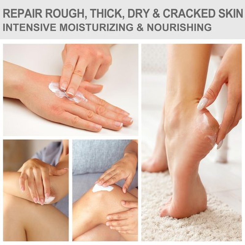 Urea Cream 40 Percent for Feet 5.29oz - Maximum Foot & Hand Cream, for Dry, Cracked Heels, Feet, Knees, Elbows, and Hands,Callus Remover, Strength Urea Lotion for Softening and Moisturizing