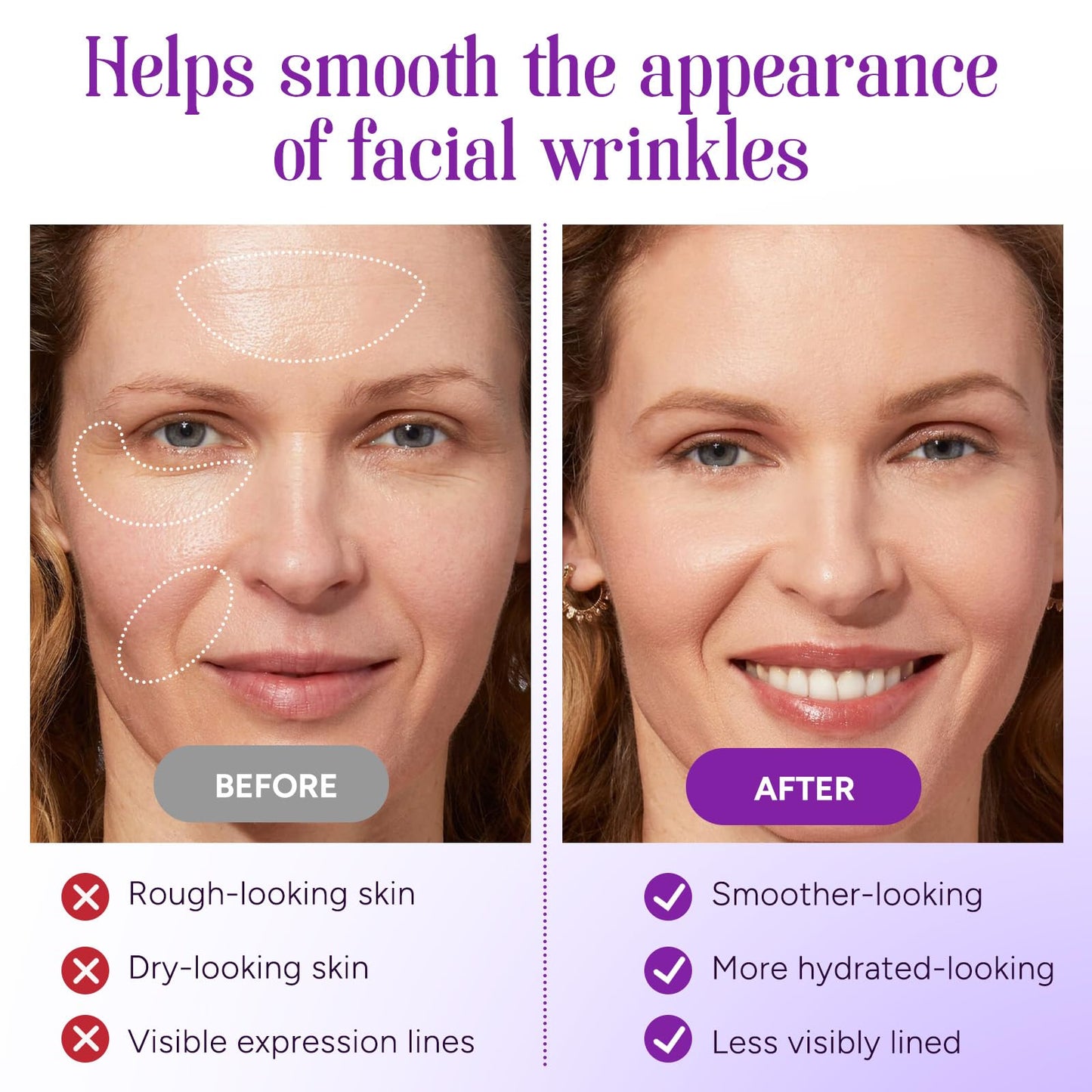 JINNAGLTU Wrinkle Patches Overnight Wrinkle Patches for Forehead, Smile Lines & Under Eyes – Face Wrinkle Patches for Smooth Youthful Skin