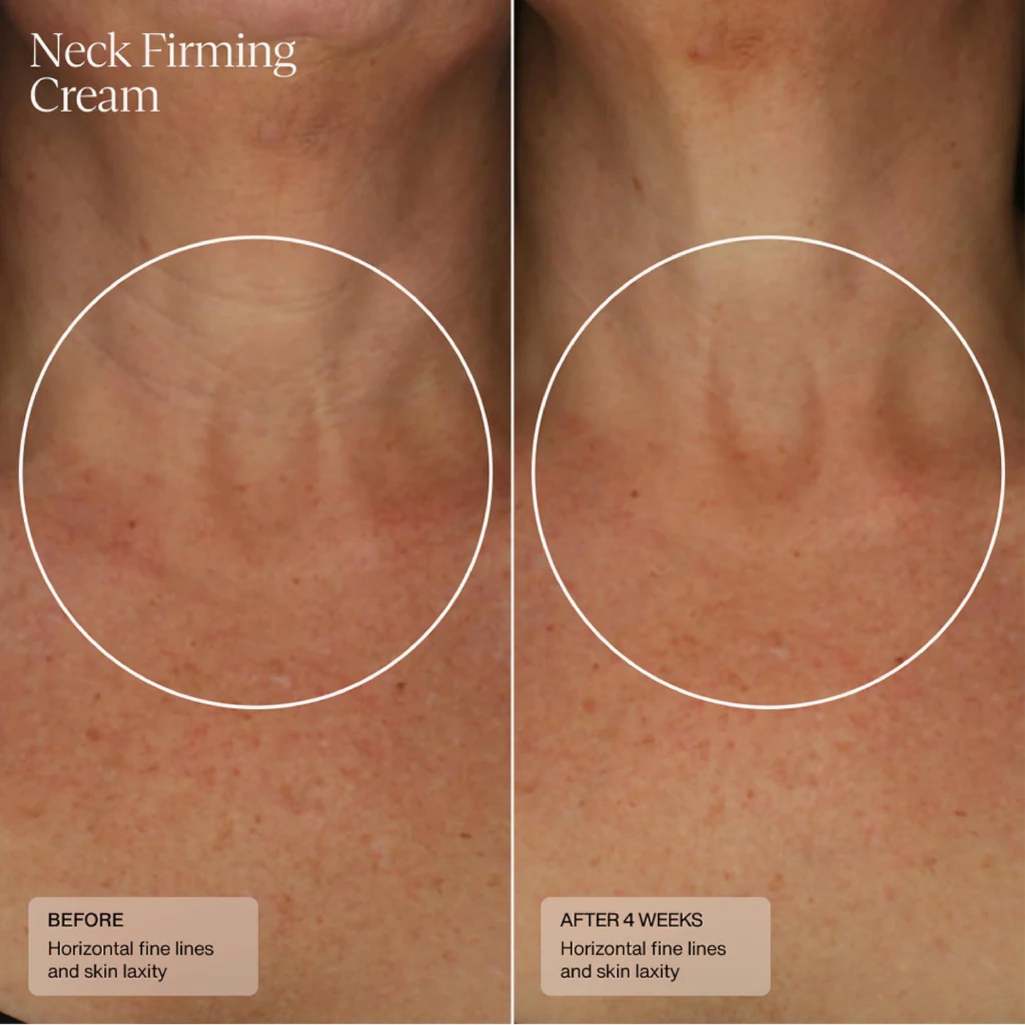 Senté Firming Neck Cream for Crepey Skin & Vertical Lines | Lifts, Firms & Smooths Neck & Décolleté | HSA, Caffeine, Vitamin C | 1.7 Fl Oz