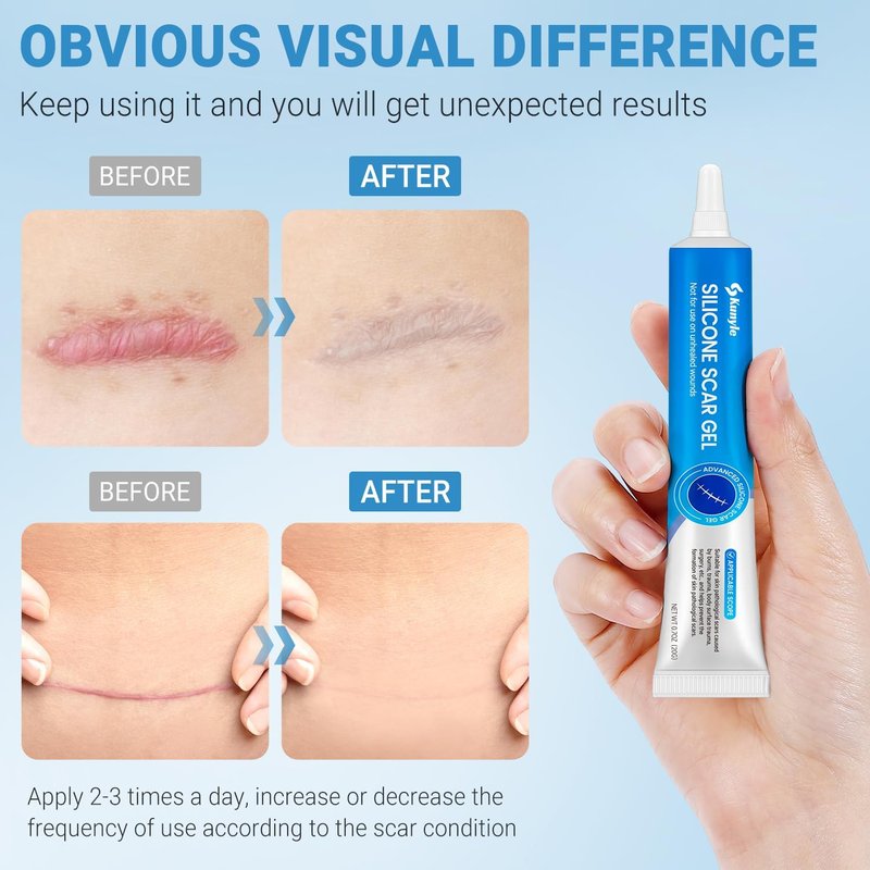 Silicone Scar Gel - Advanced Scar Treatment for Surgical Scars, Stretch Marks & Keloids | 0.70oz (20g)