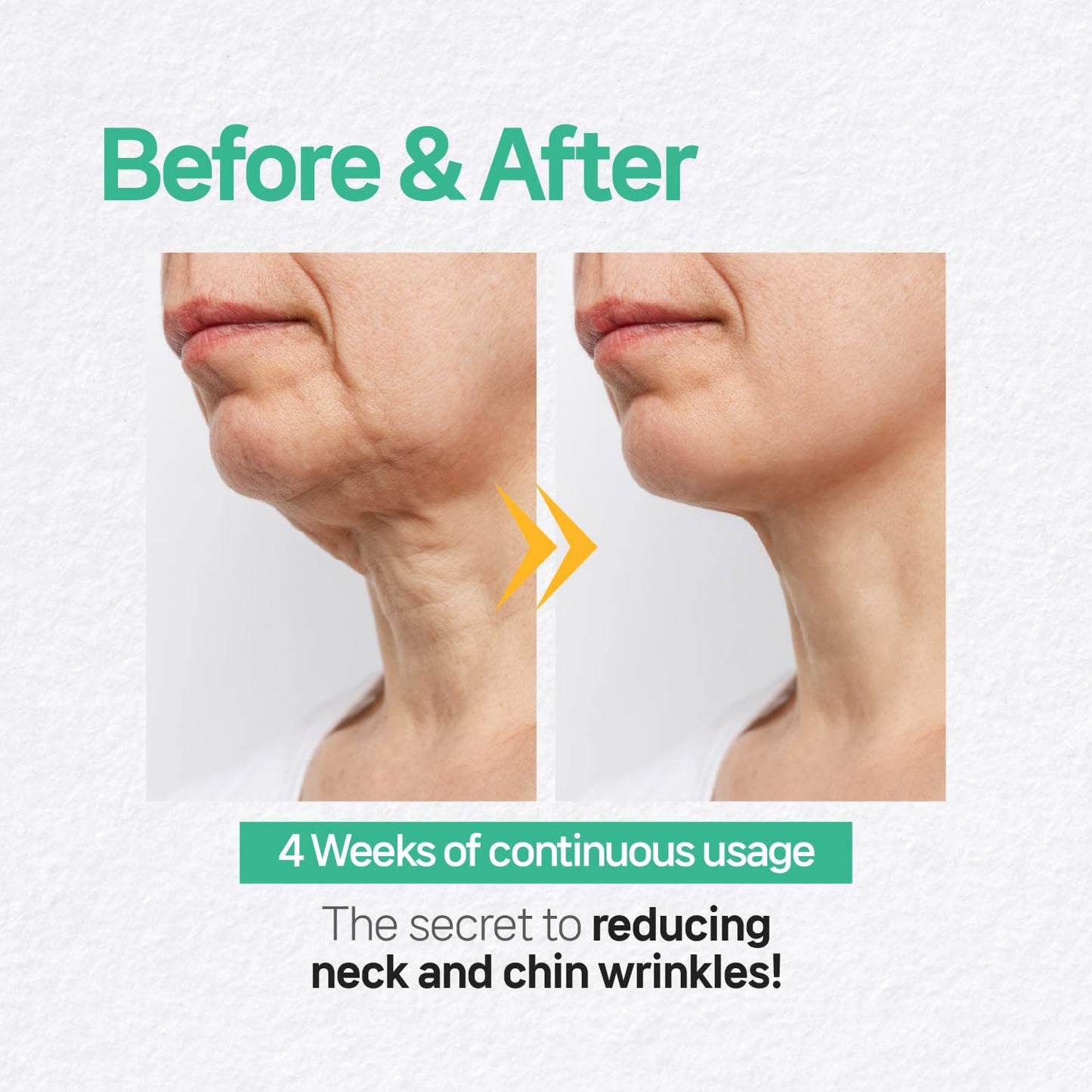 Wooshin Labottach Chin Lifting Mask 4ct – Korean Hydrogel Neck & Chin Patch for Sagging Skin, Neck Wrinkle Patches & V-Line Lifting, Firming Overnight with Hyaluronic Acid & Vitamin E