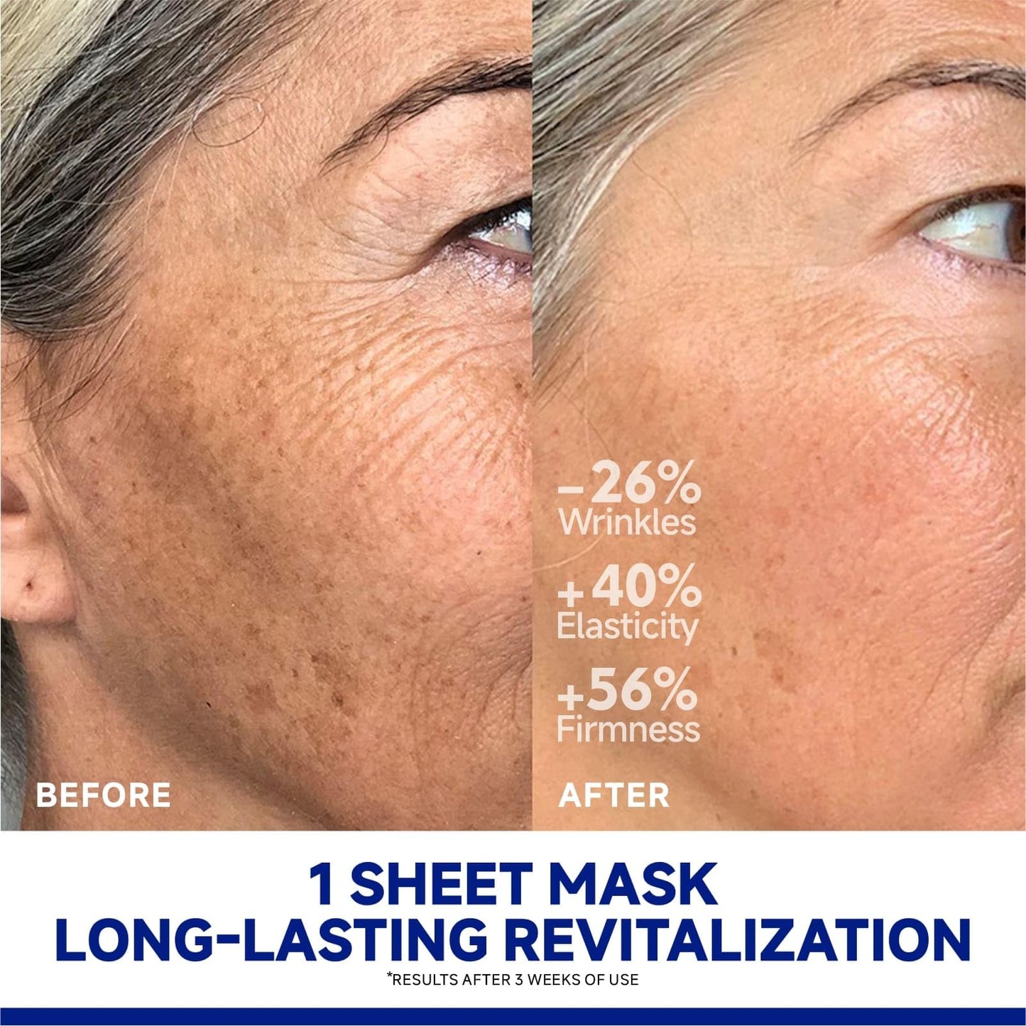 Dr Vincent Deep Hydrating Overnight Collagen Hydrogel Mask, Soothing Facial Mask for Calm Skin & Improve Firm-Looking Appearance, Peptides Renew Facial Masks for All Skin Types, 37gx5ea