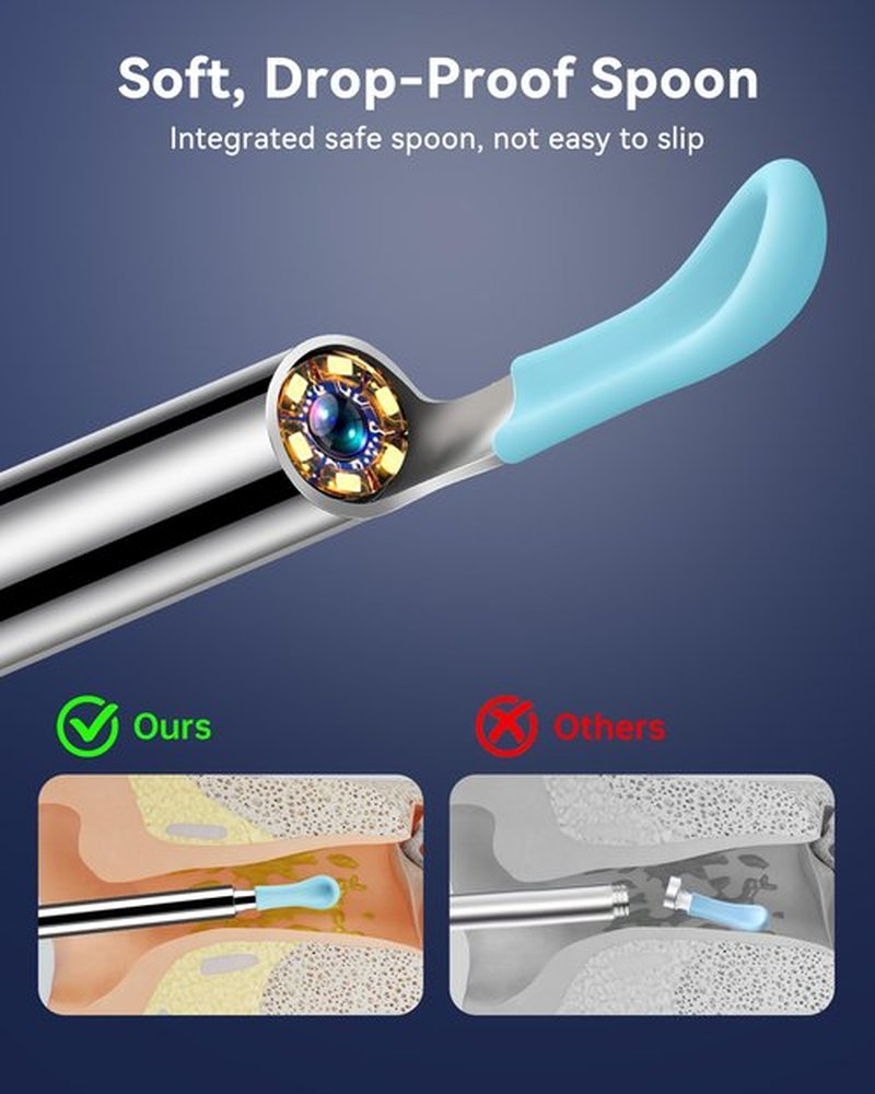 Ear Wax Removal Tool Camera, 1080P HD Scope and 6 LED Lights, Ear Cleaner with Camera, Ear Cleaning Kit - Earwax Remover Tool with 5 Spoon (Onyx)