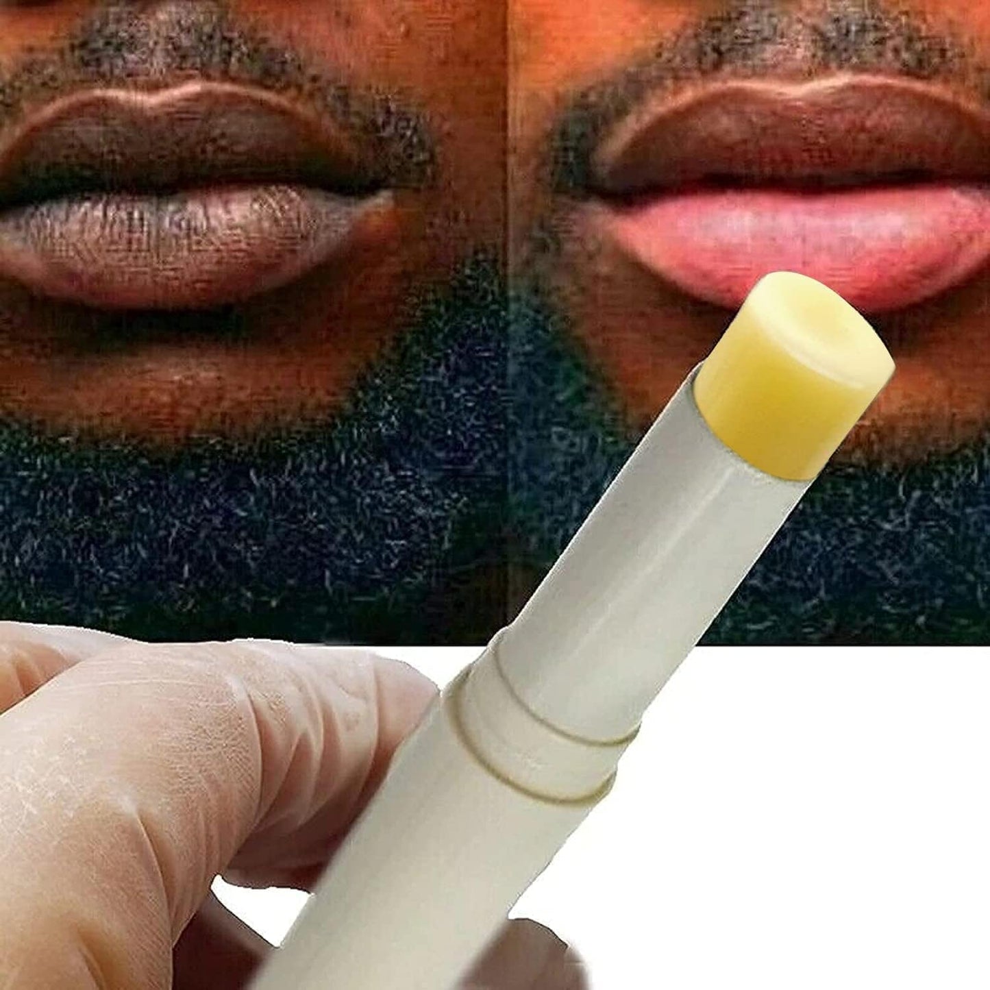 2PCS Natural Plant Lip Balm for Dark Lips,Exfoliating Lip Scrub, Moisturizing Lip Hyaluronic Acid Exfoliating Dead Skin, Fade Lip Lines,Lip Balm for Smokers, Restore Natural Lip Complexion (YELLOW)