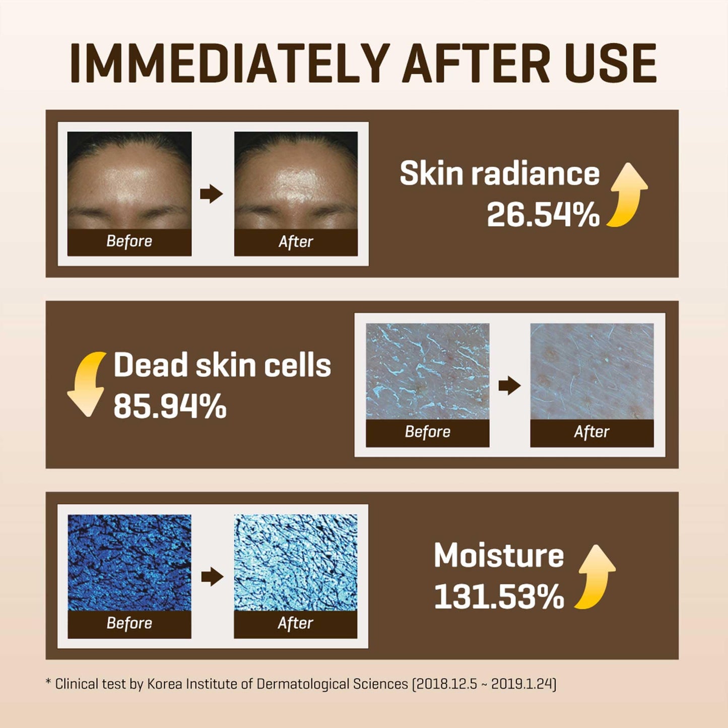SOME BY MI Galactomyces Pure Vitamin C Glow Toner - 6.76Oz, 200ml - Korean Daily Vitamin C Face Toner for Skin Brightening - Glass Skin Routine with Skin Texture, Elasticity Care - Korean Skin Care